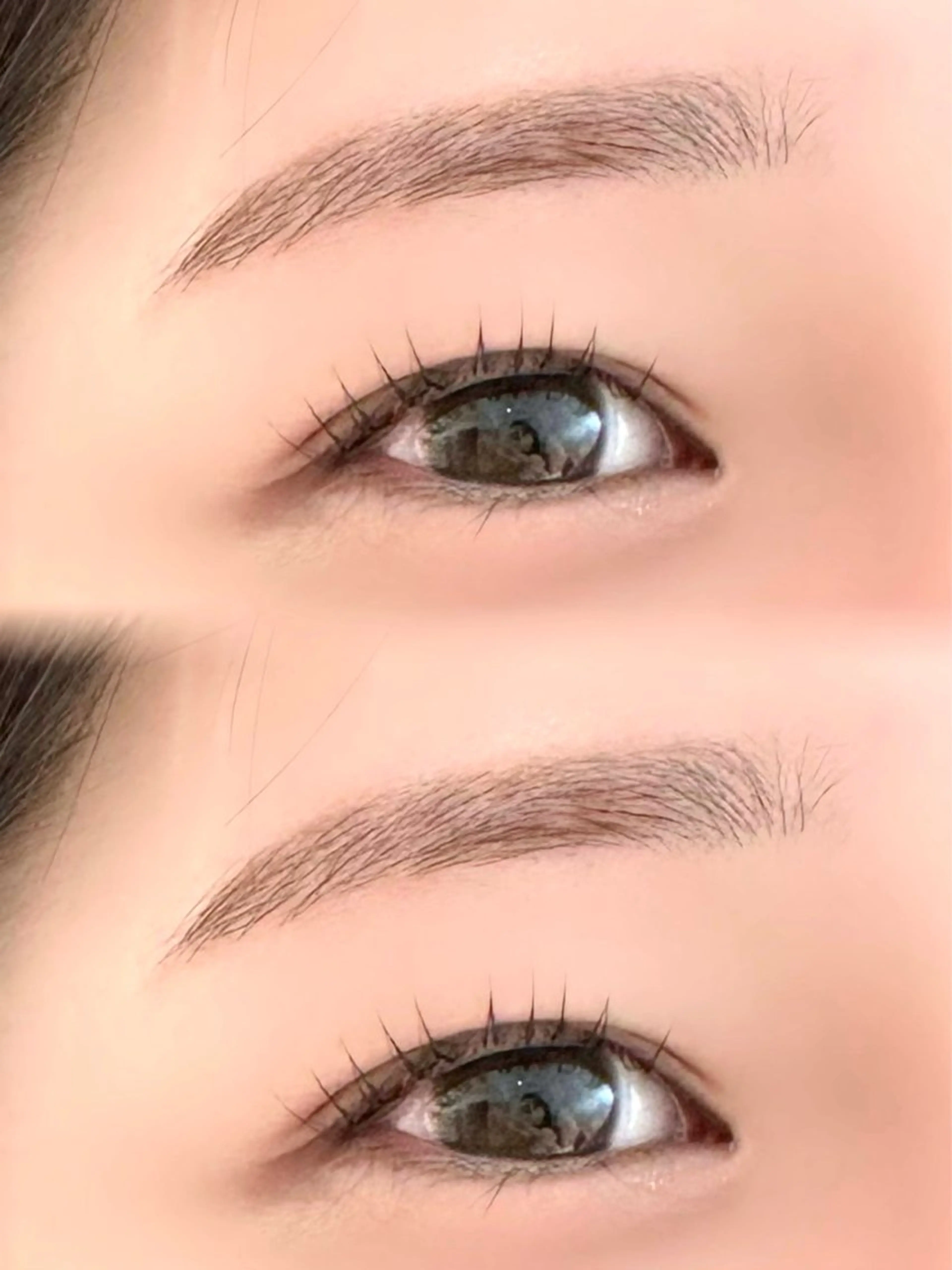 ワックス脱毛の写真