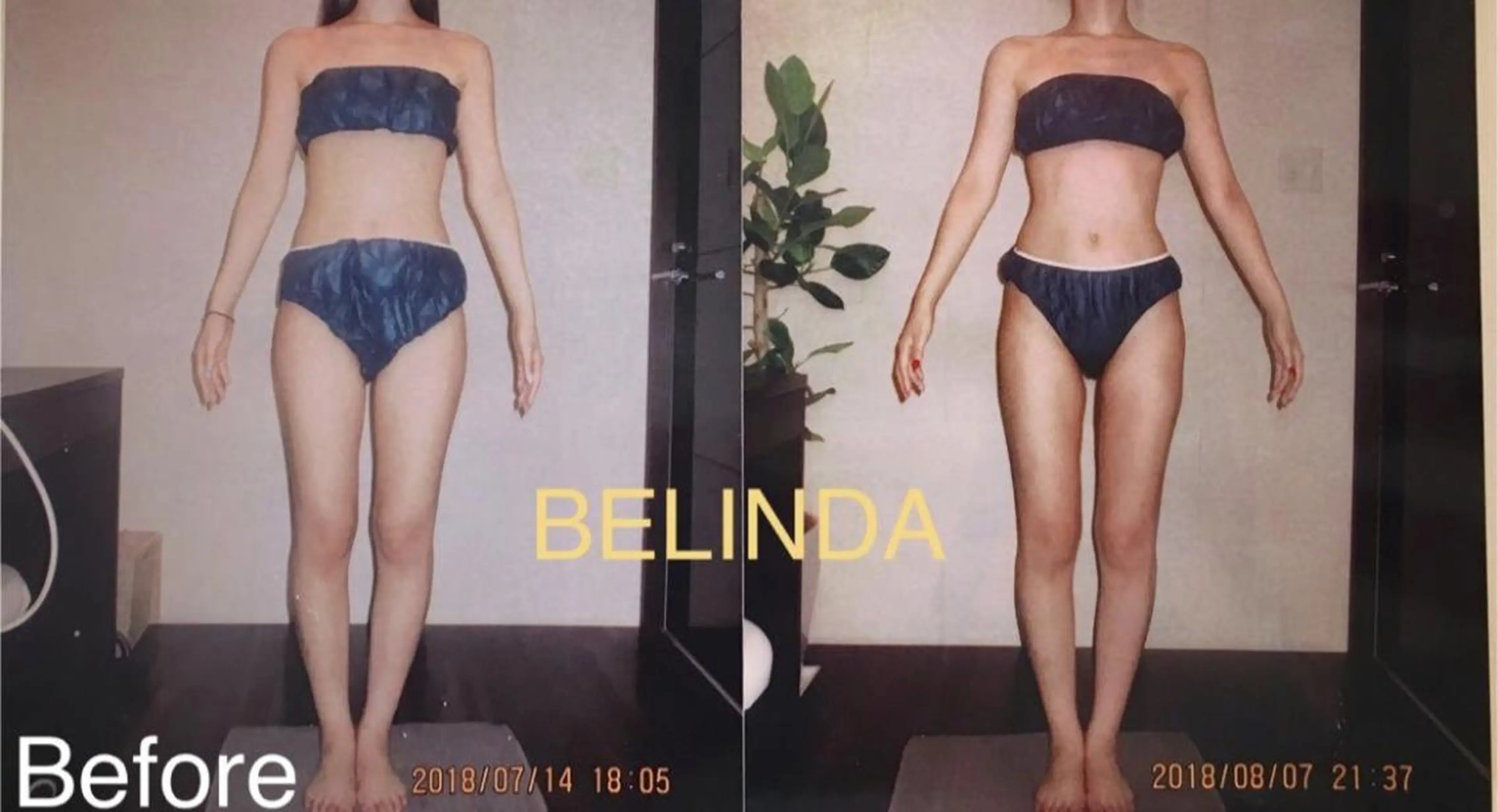 エステ BELINDA銀座店 ✨痩身エステサロン✨のエステ・リラクイメージ