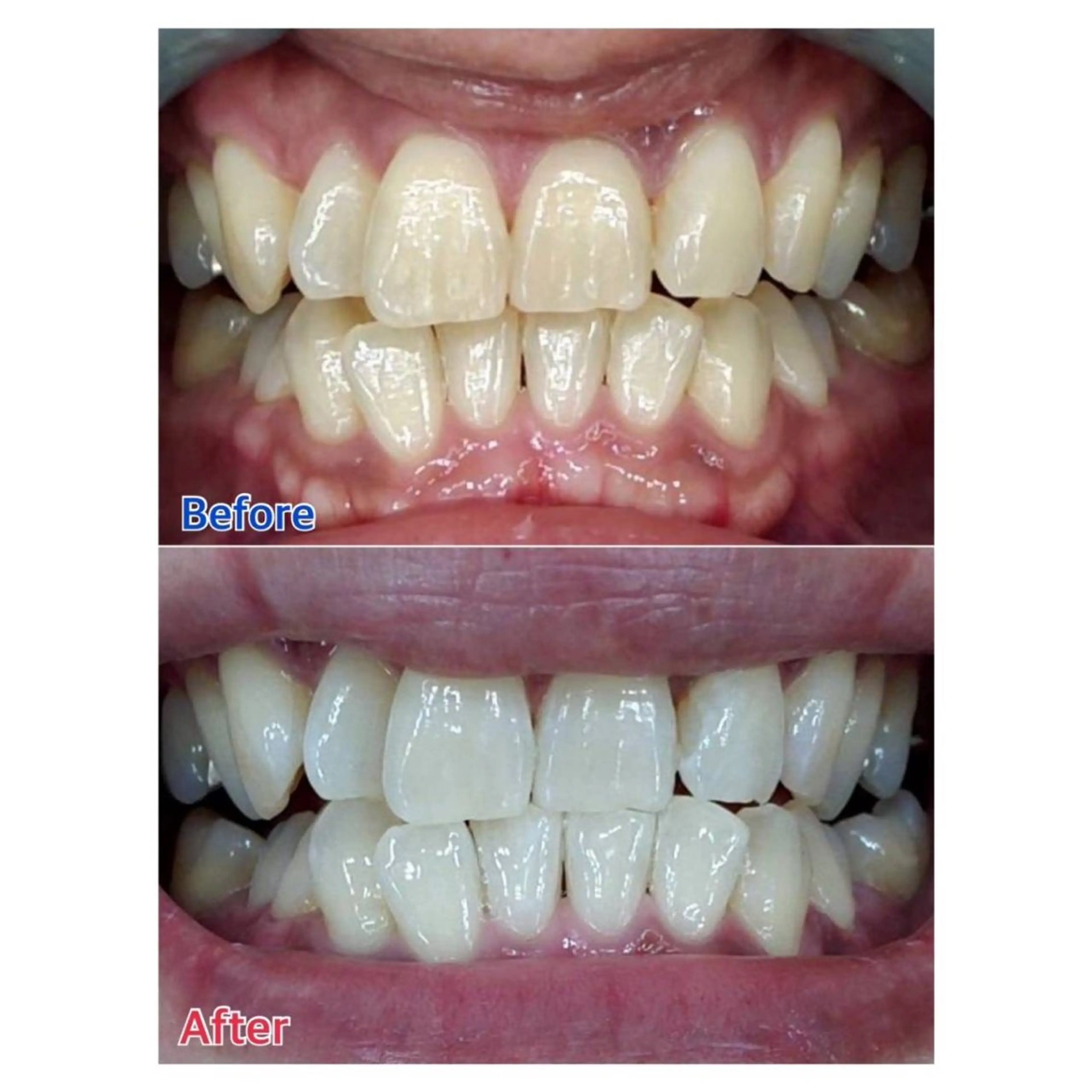 MBEAUTYSALON 千葉店・京成大久保所属・Melty 輝のその他イメージ