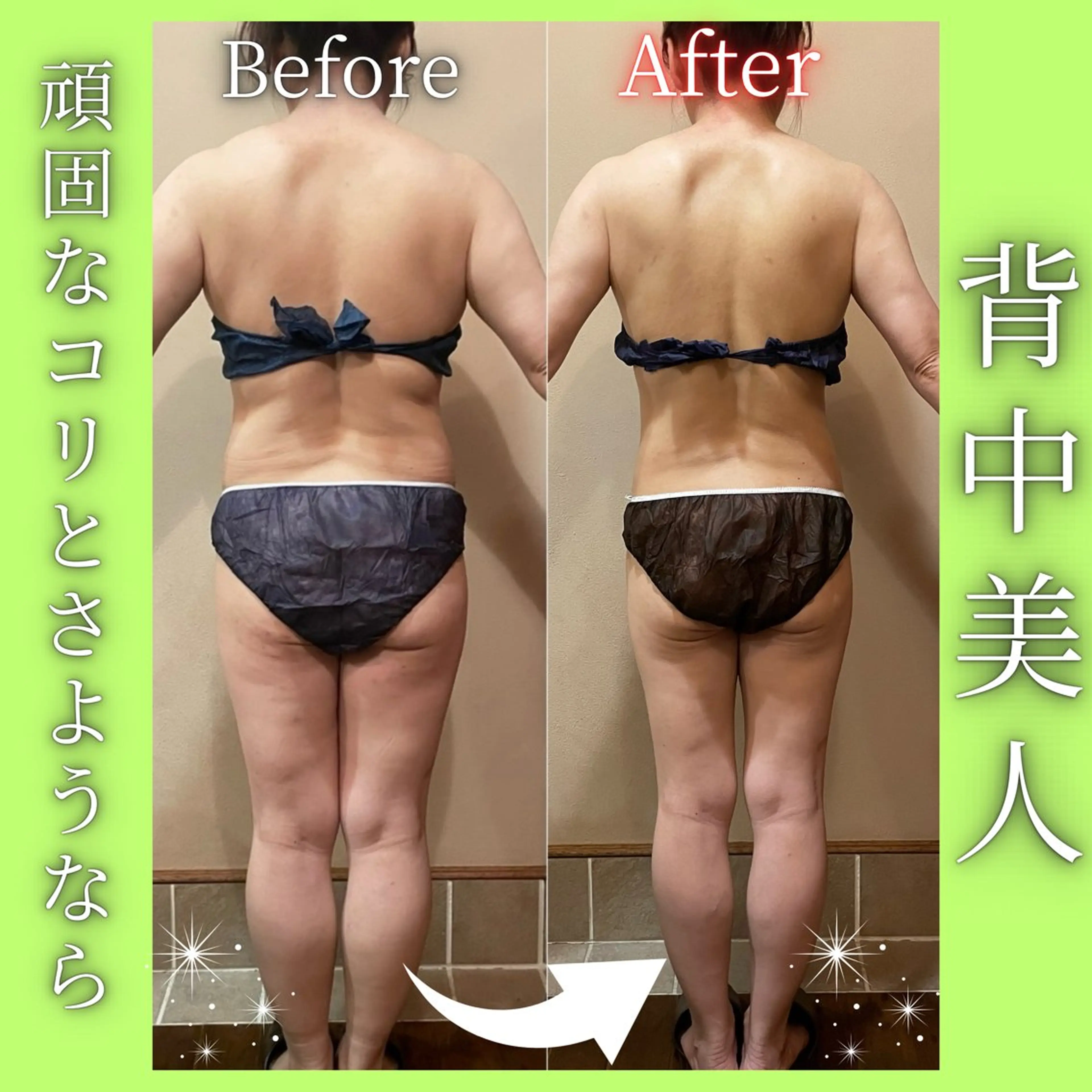美ライン造形💎上半身筋膜リリース×燃焼ラフォスでガチガチに固まったお身体をしっかりほぐす！短期集中痩せ🧸の写真