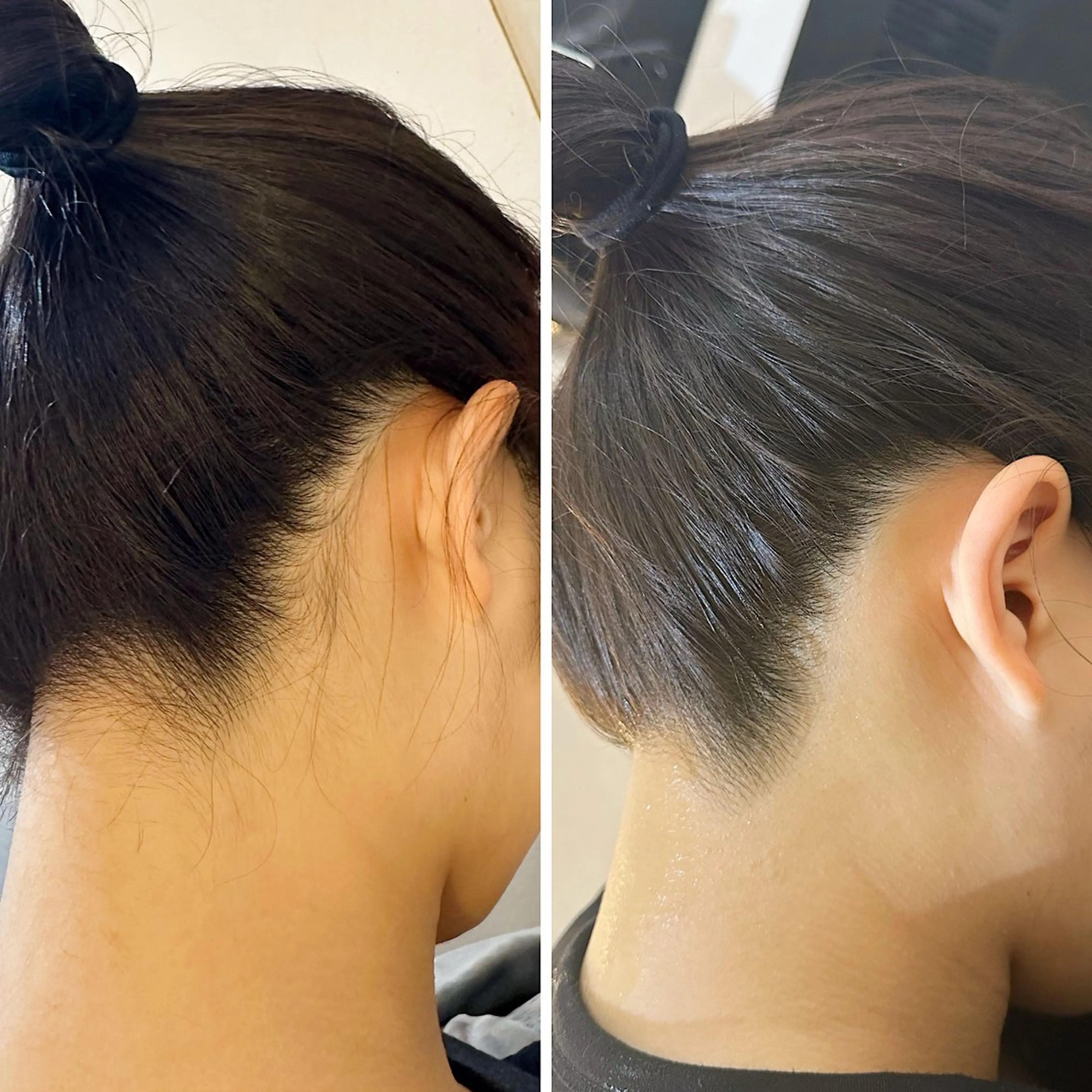 脱毛 うなじ脱毛/美肌脱毛 LABELのエステ・リラクイメージ