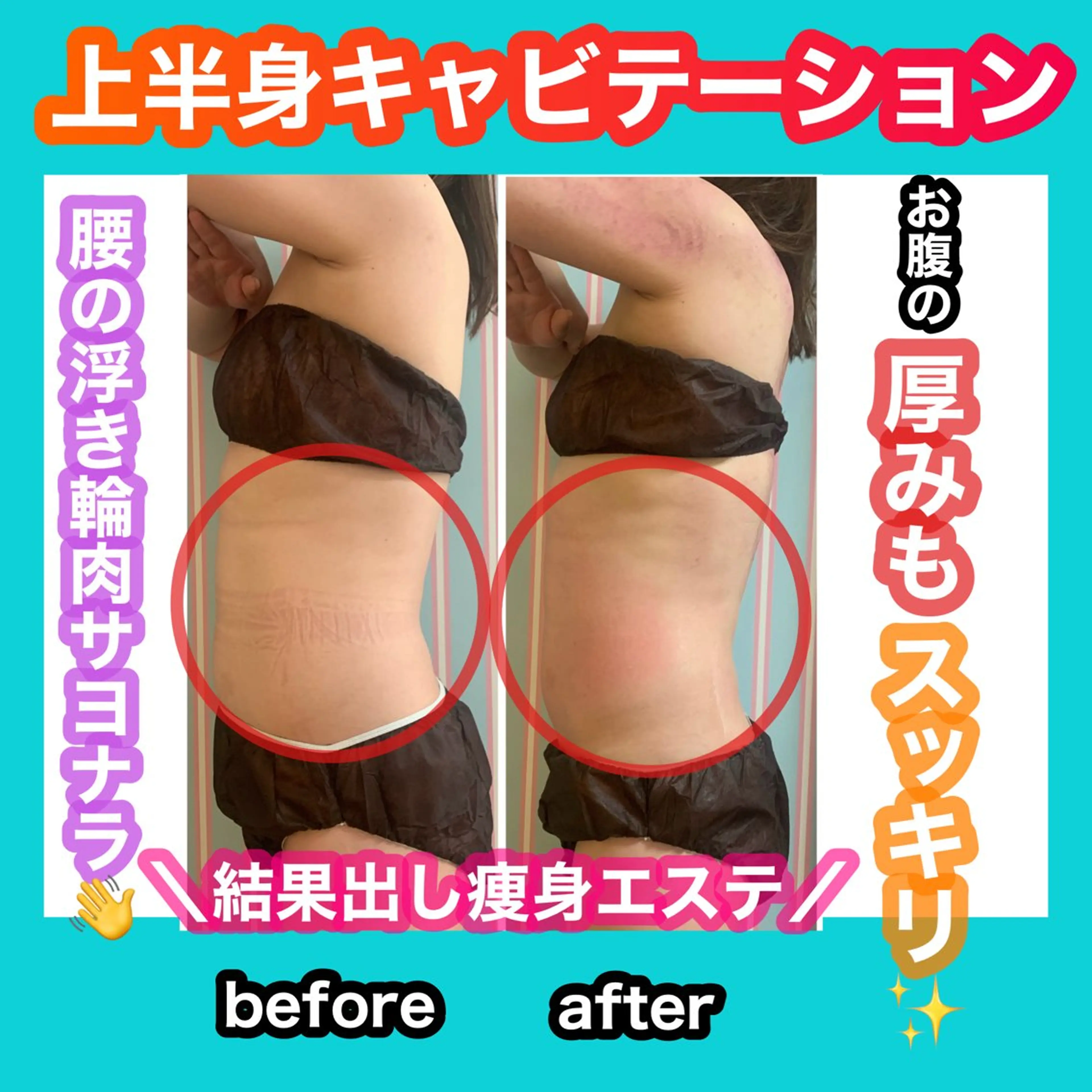 エステ リラク 痩身/脱毛/ネイル HARUKAのエステ・リラクイメージ