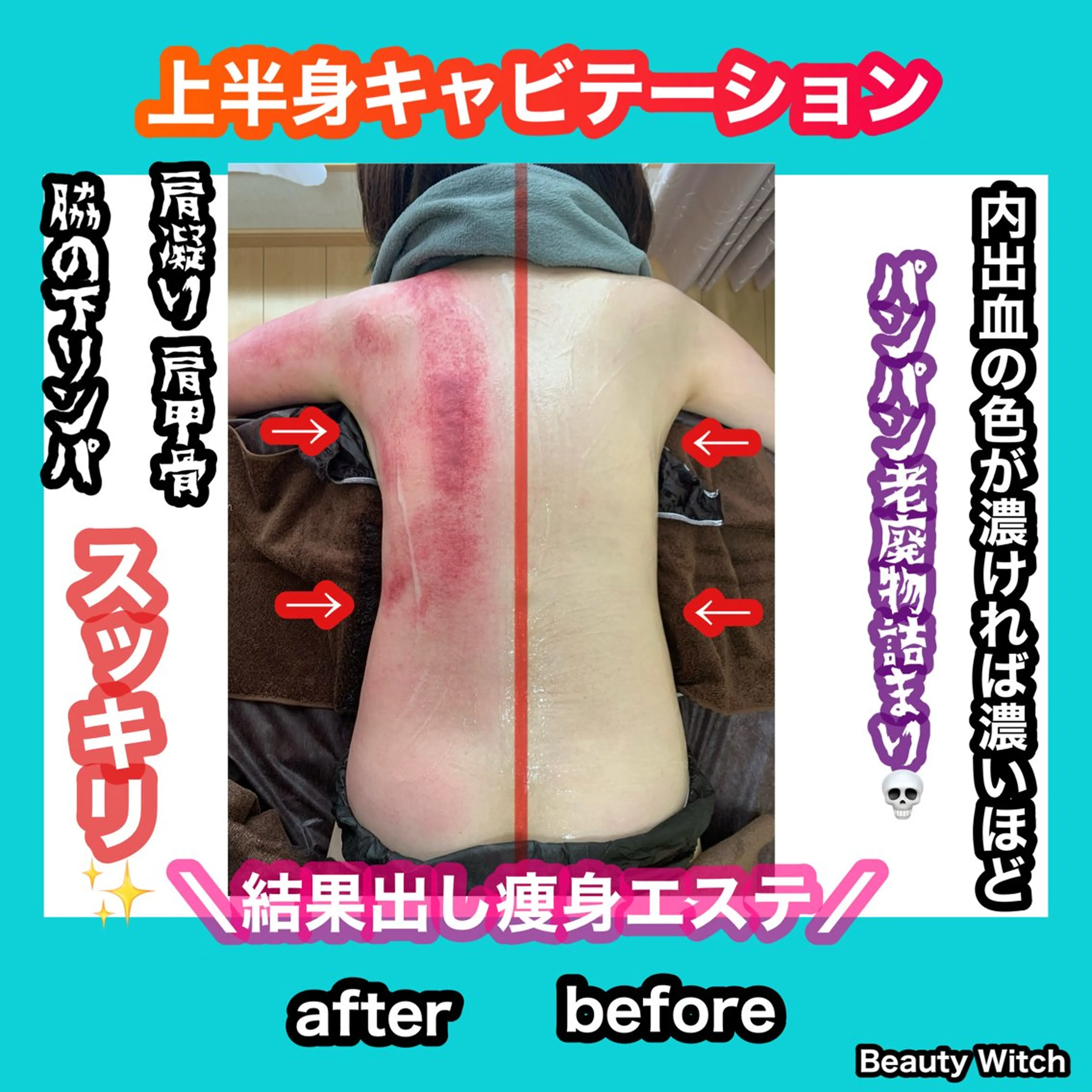 エステ リラク 痩身/脱毛/ネイル HARUKAのエステ・リラクイメージ