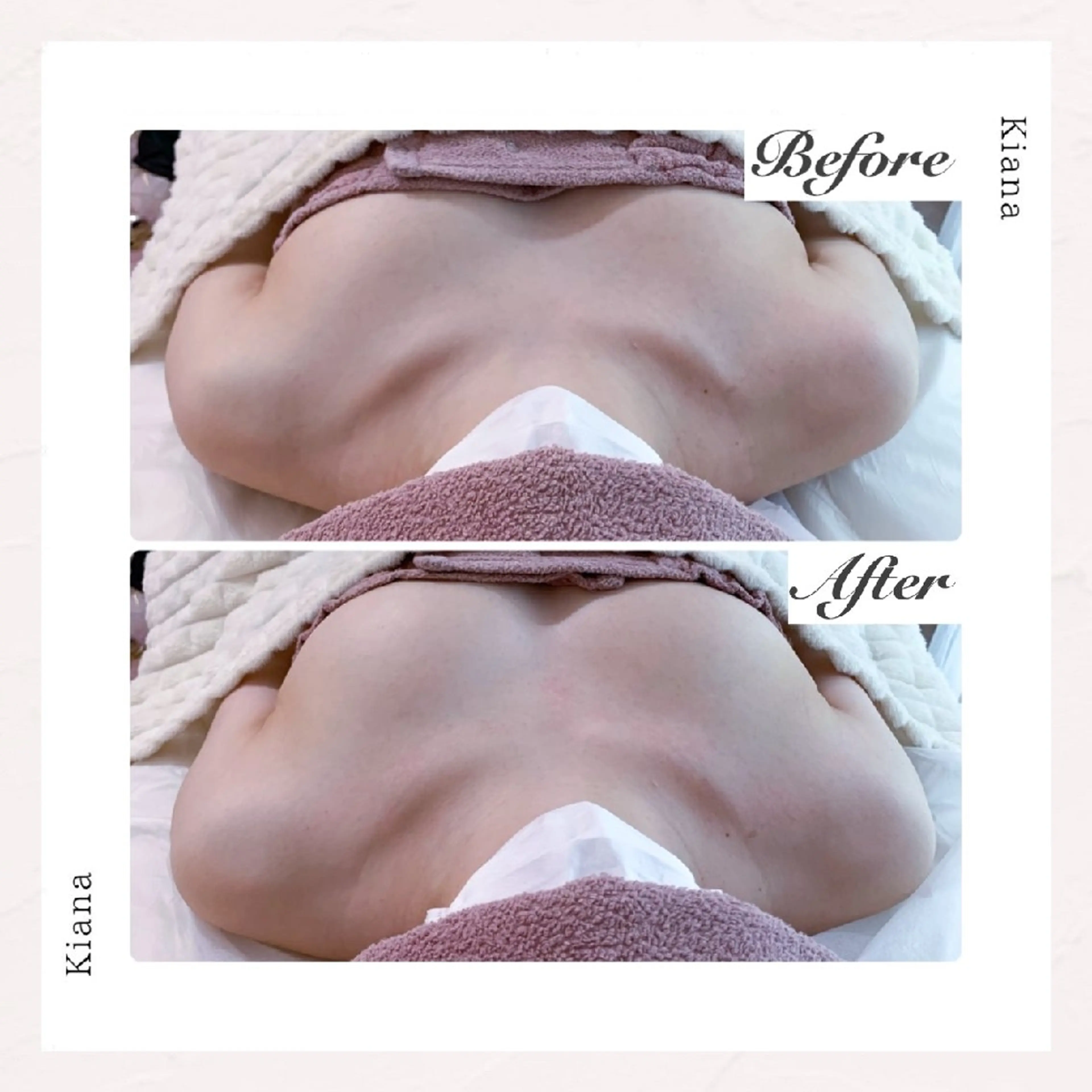 【バスト専門店 】 Kiana のエステ・リラクイメージ