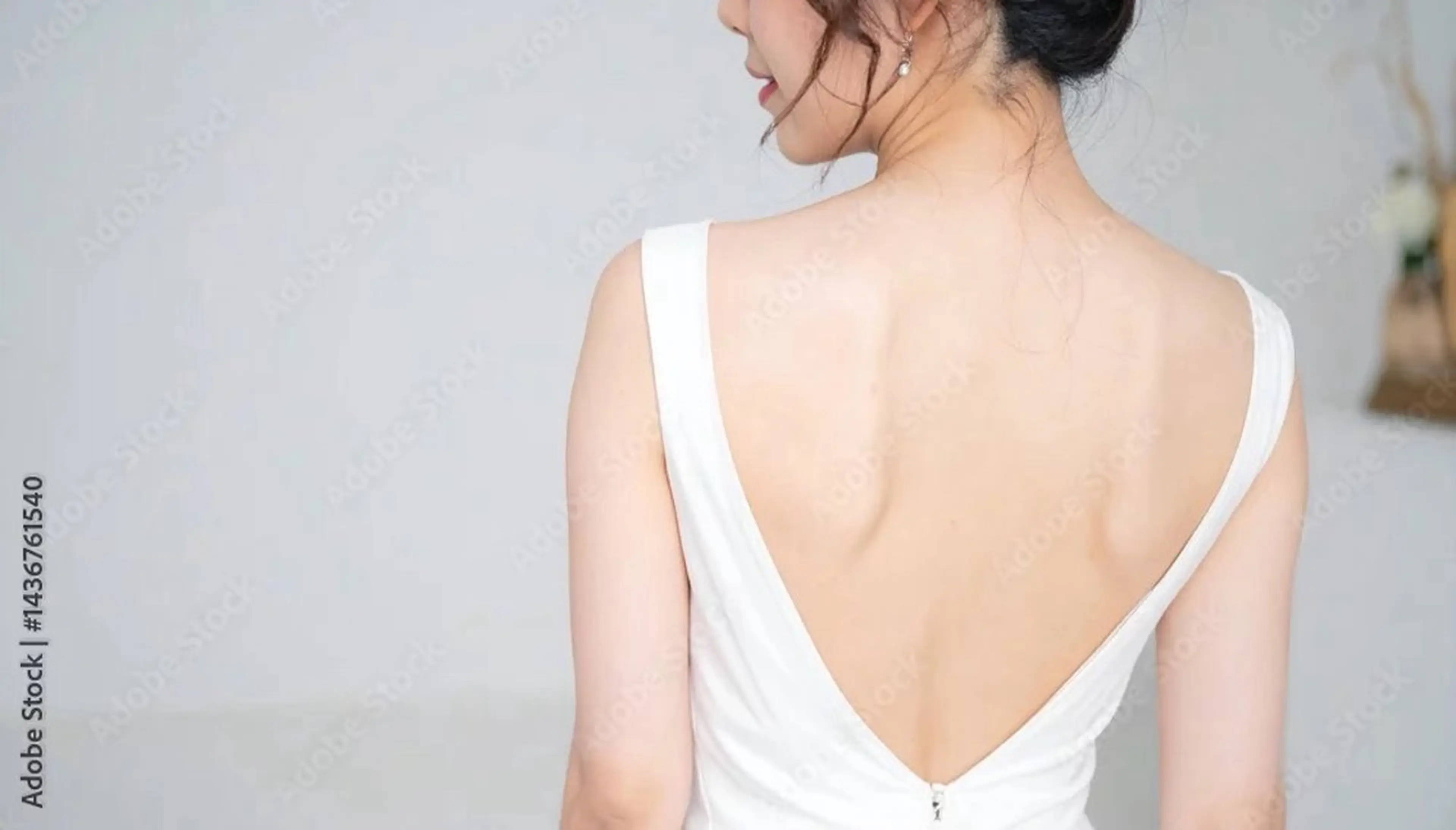 全身脱毛(顔、VIO除く)の写真