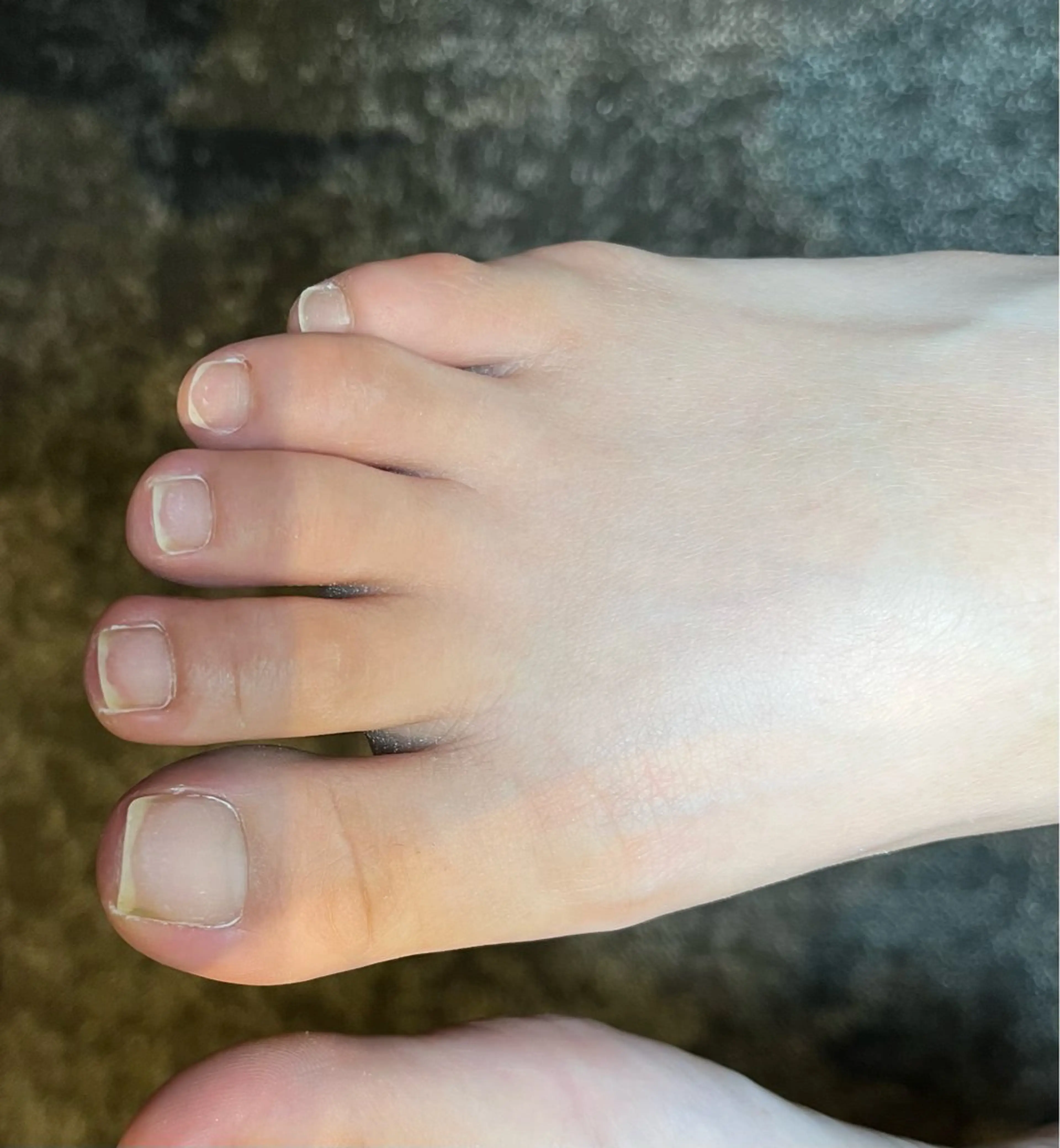 ネイル その他(ネイル) NAILSALON FROSCH所属・FROSCH/ 凜のネイルデザイン