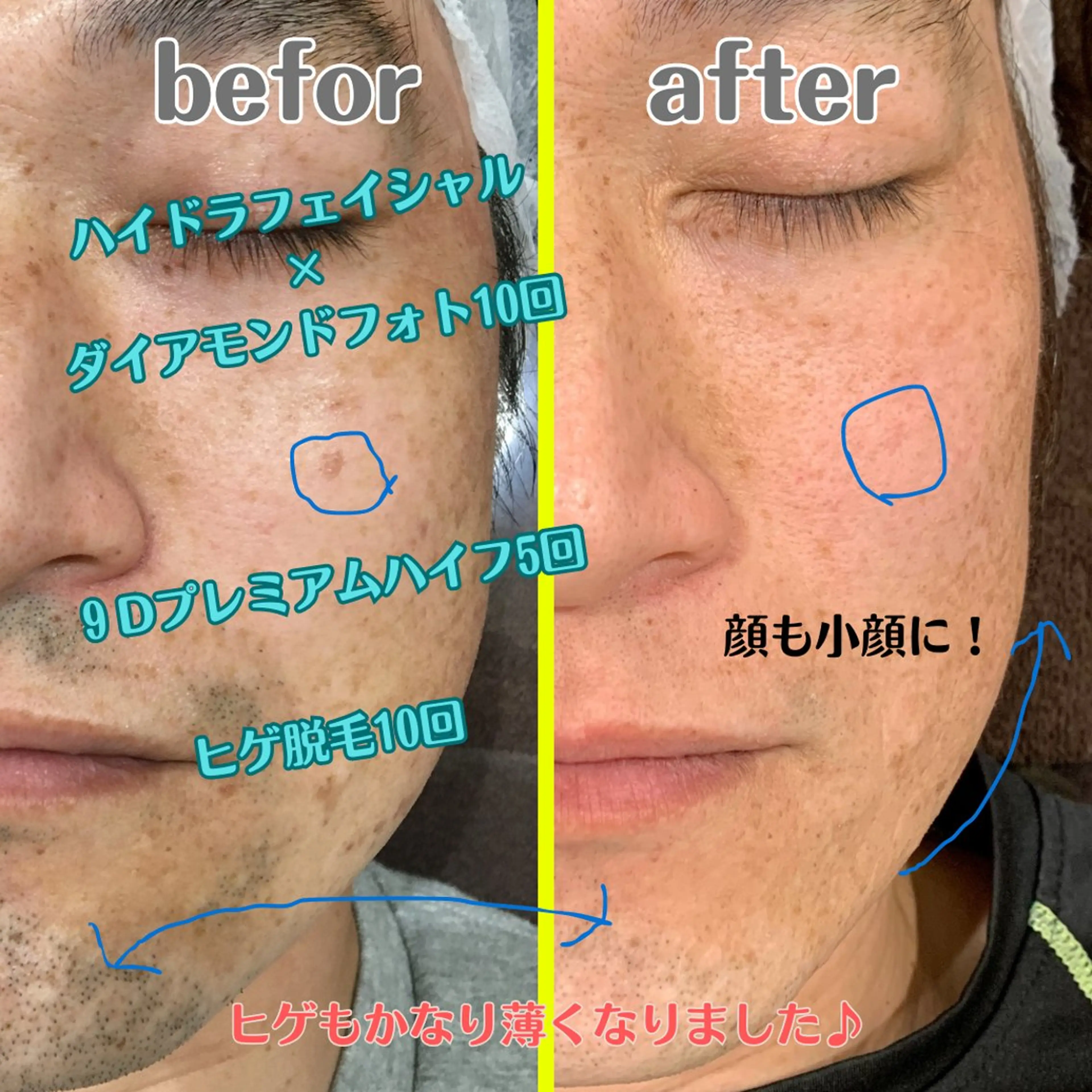エステ vary  clue MISAのその他イメージ