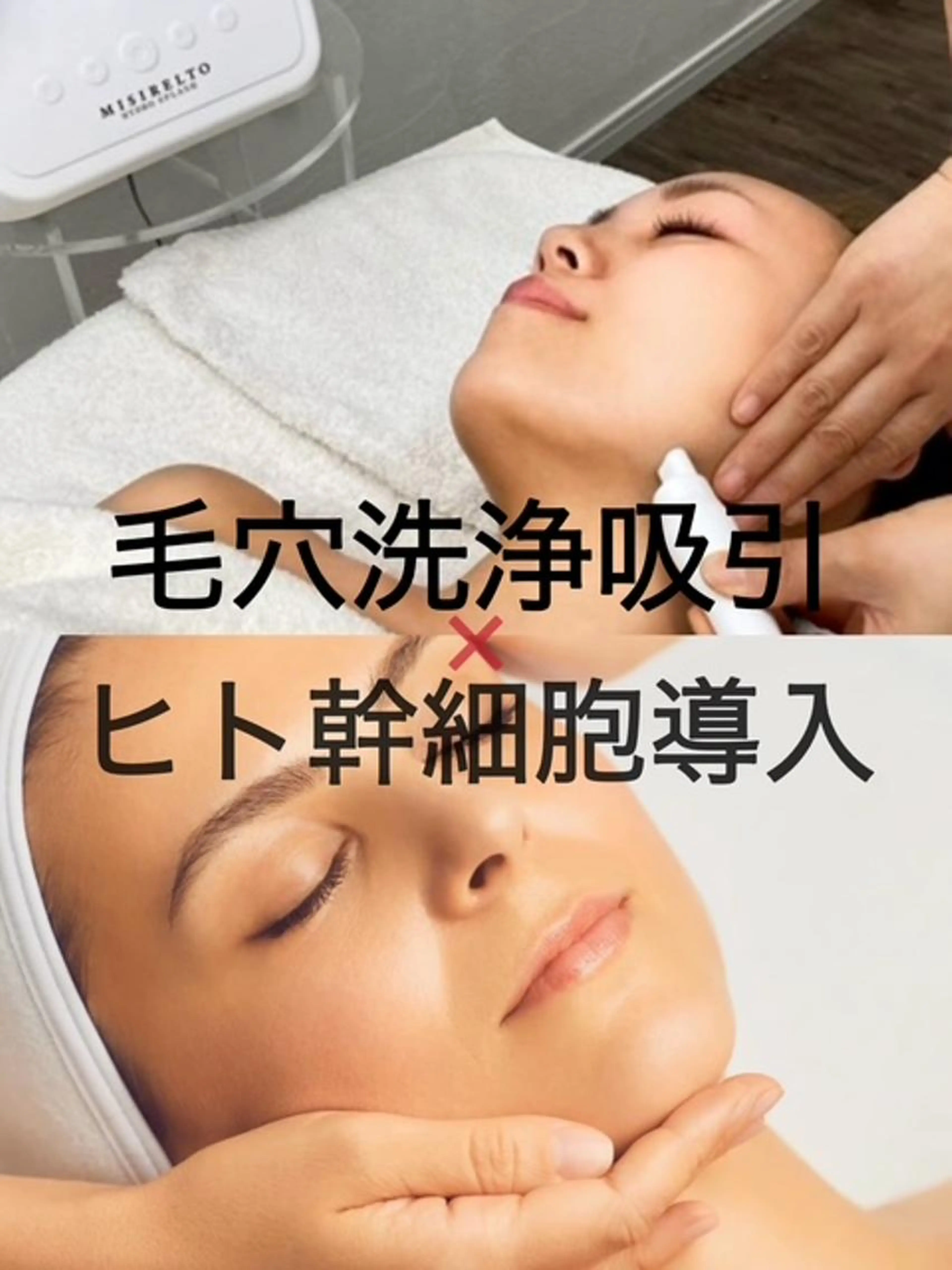 【8月末迄限定】(毛穴＆高保湿)夏のダメージ肌に◎全顔毛穴洗浄+ヒト幹細胞導入￥5500の写真