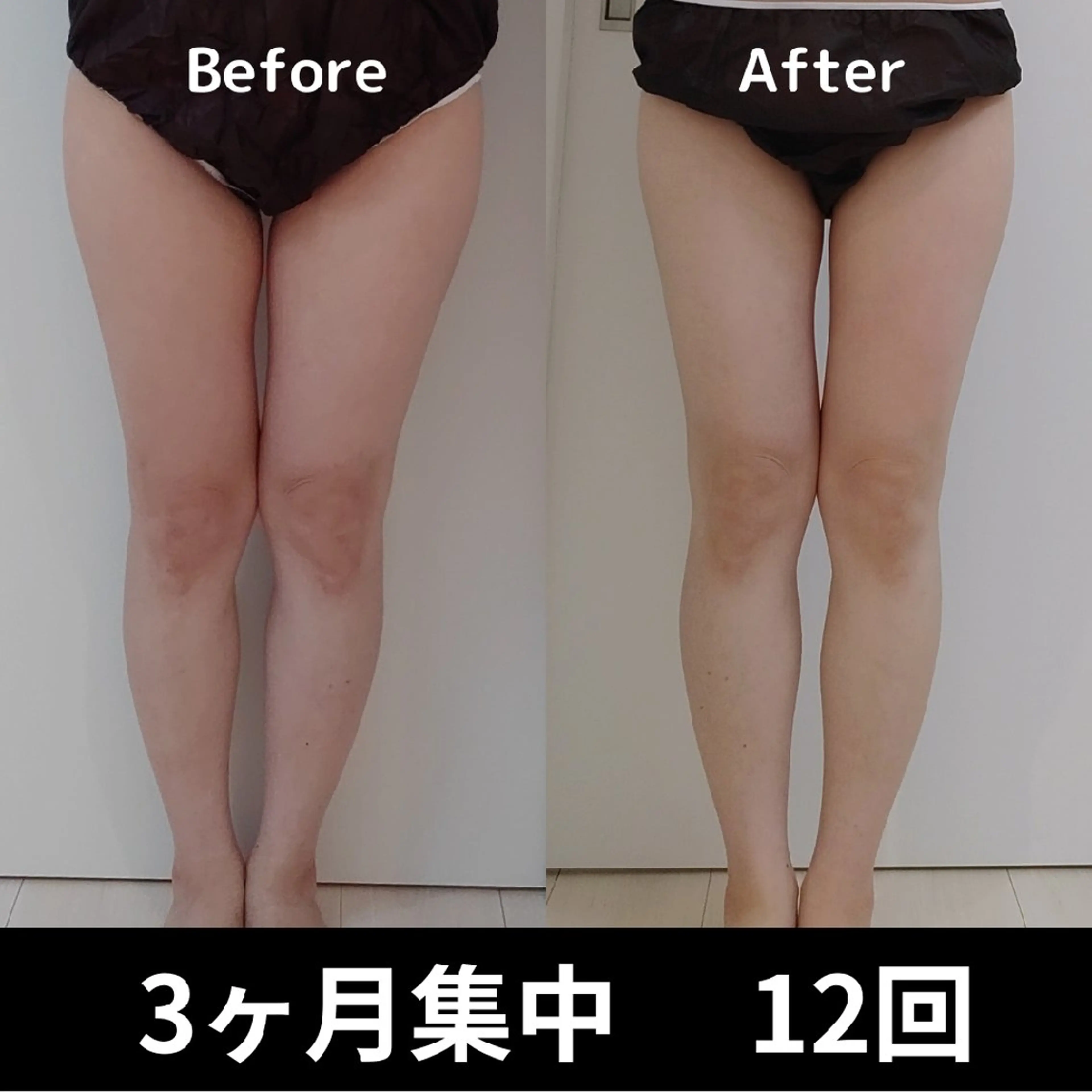 エステ リラク ユニセックスエステサロンUniclear所属・男女エステユニクリア Uniclearのエステ・リラクイメージ