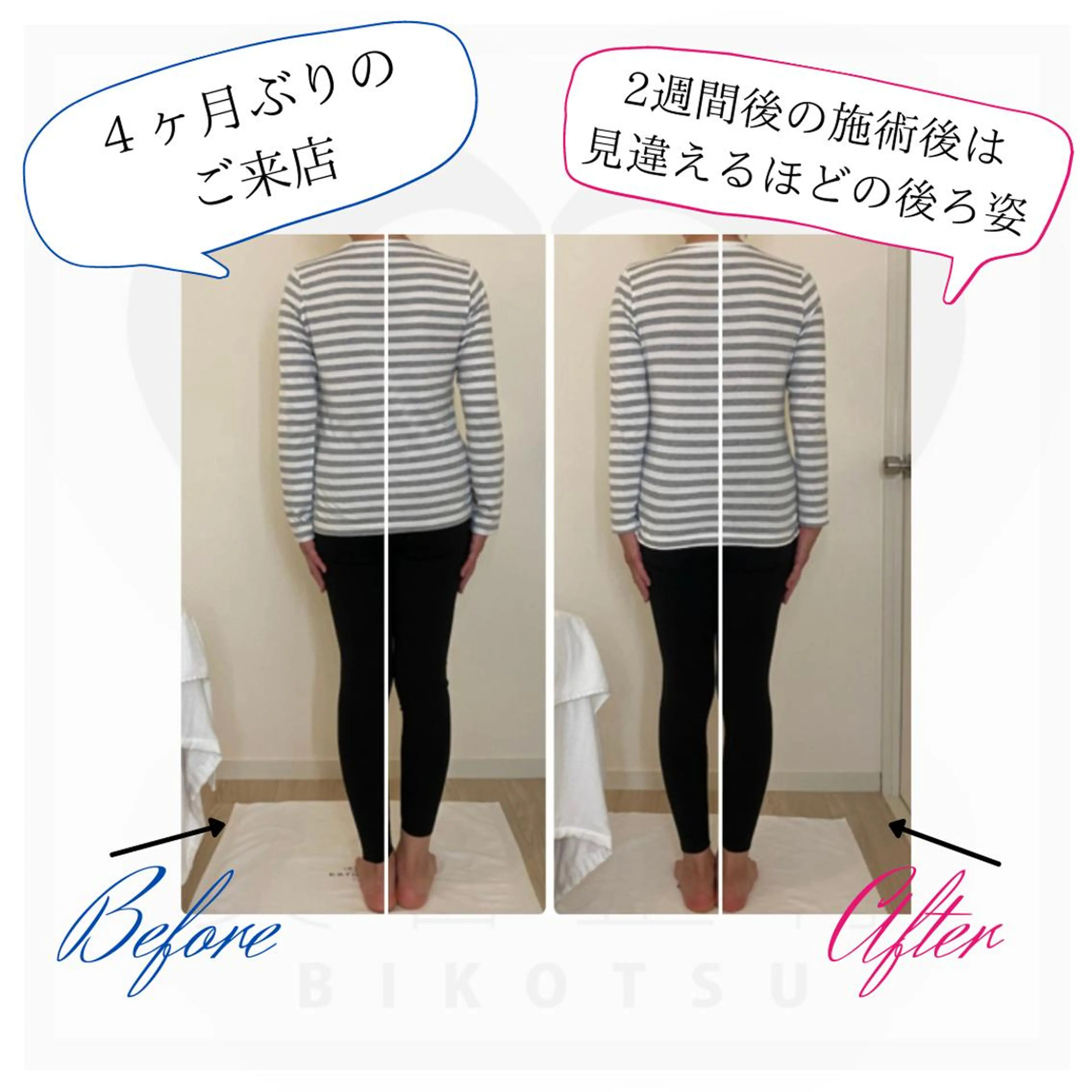 肌質改善|天王寺 For...はるかのエステ・リラクイメージ