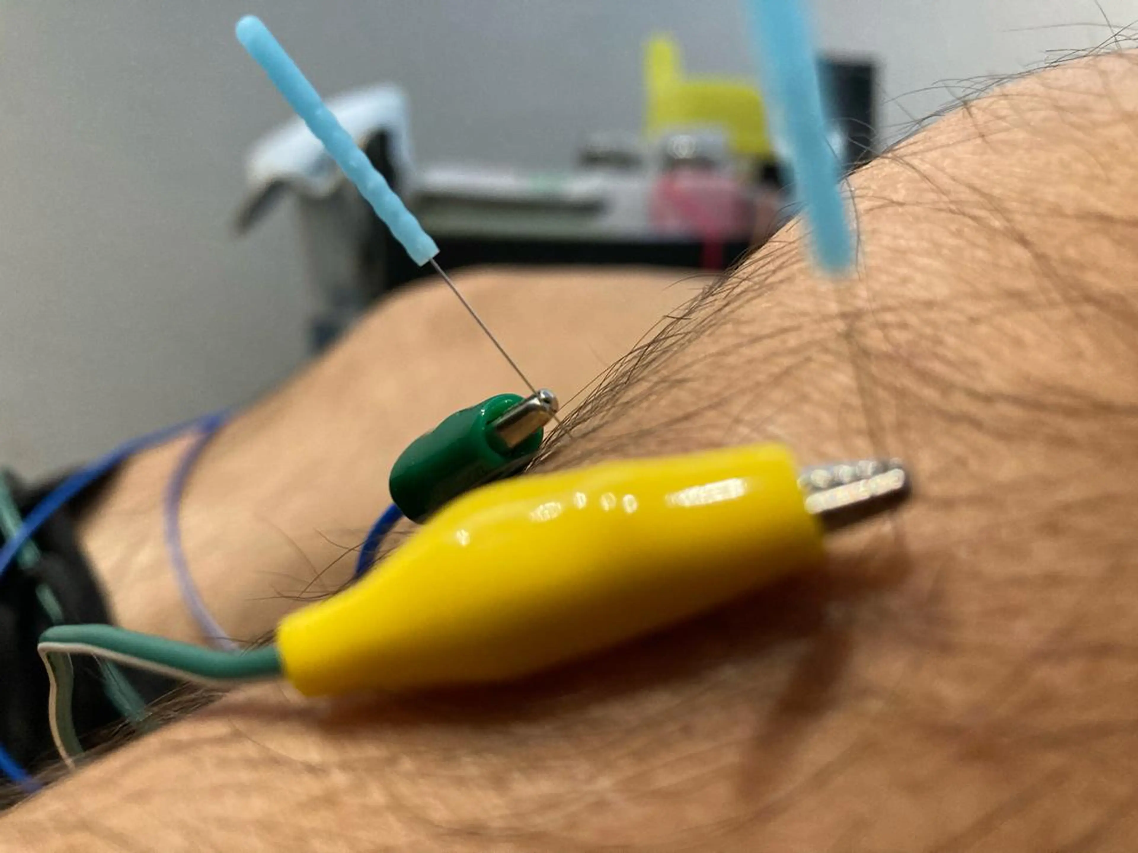 その他 美容鍼灸整体サロンBeauJu所属・小顔矯/美容鍼/鍼灸 BeauJuのその他イメージ