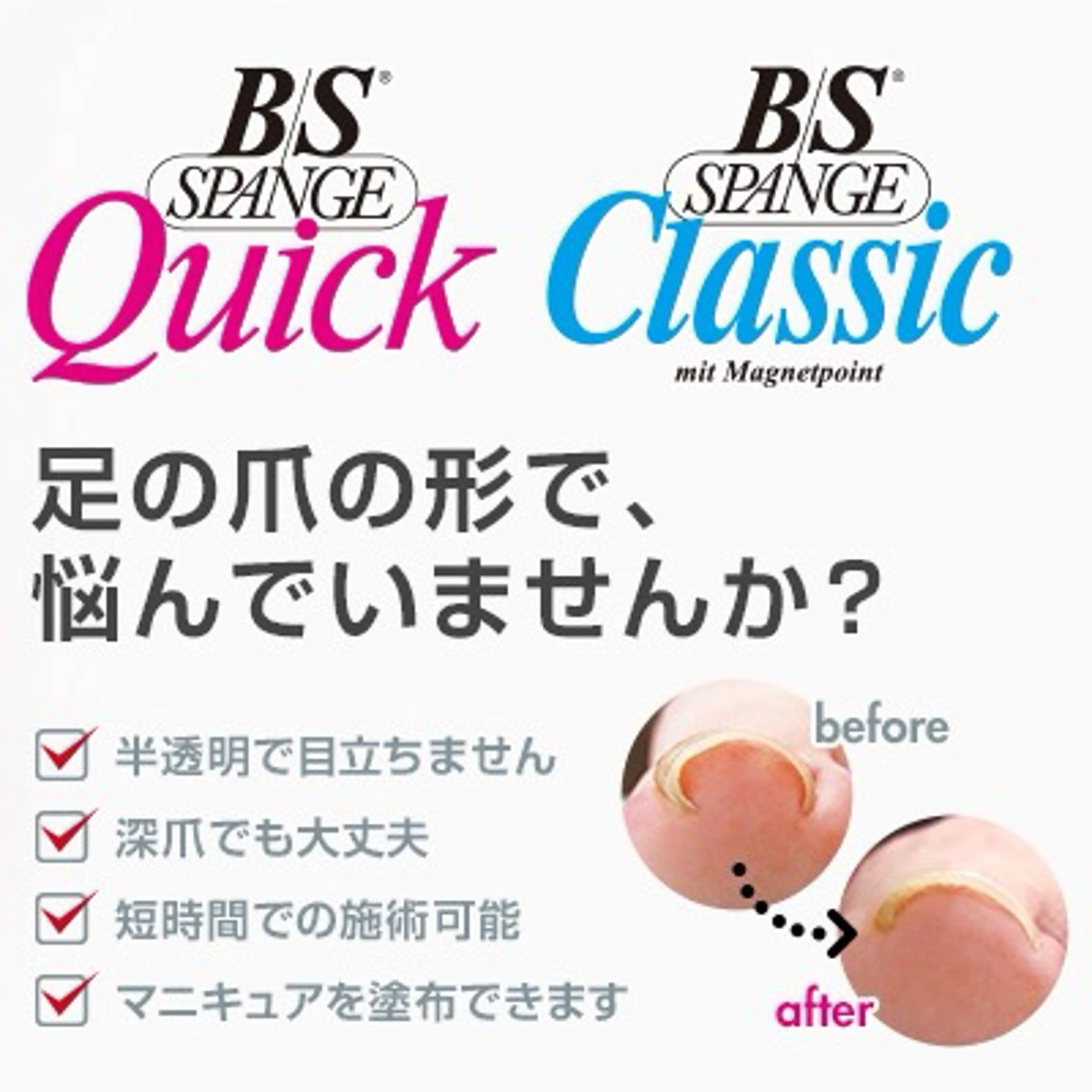 巻き爪ケア #オススメの巻き爪ケア #bs4種を分かりやすく表に