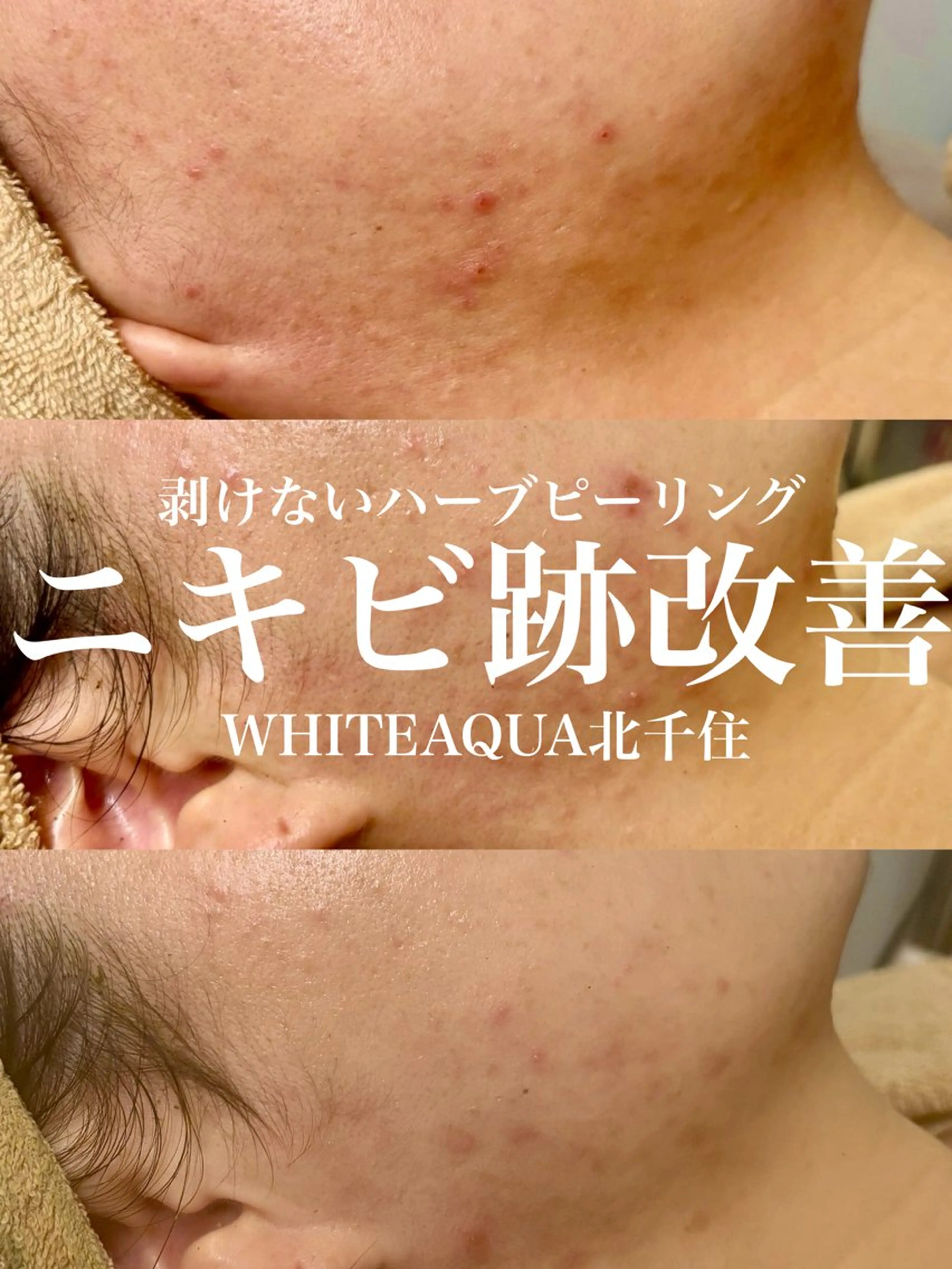 エステ WHITE AQUA 北千住店のエステ・リラクイメージ