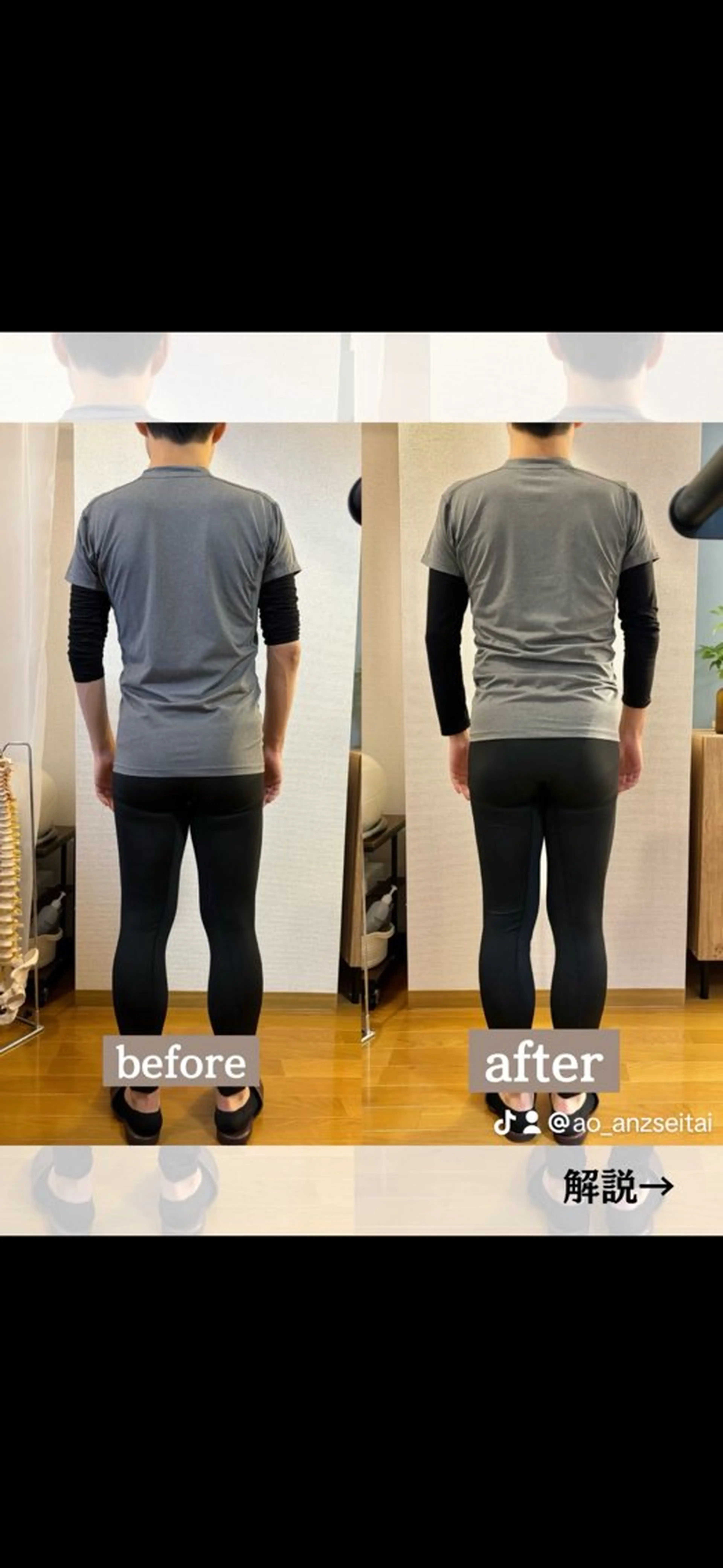 メンズ ANZ美容整体所属・美姿勢|痩身|目黒 ANZ-美容整体-のエステ・リラクイメージ