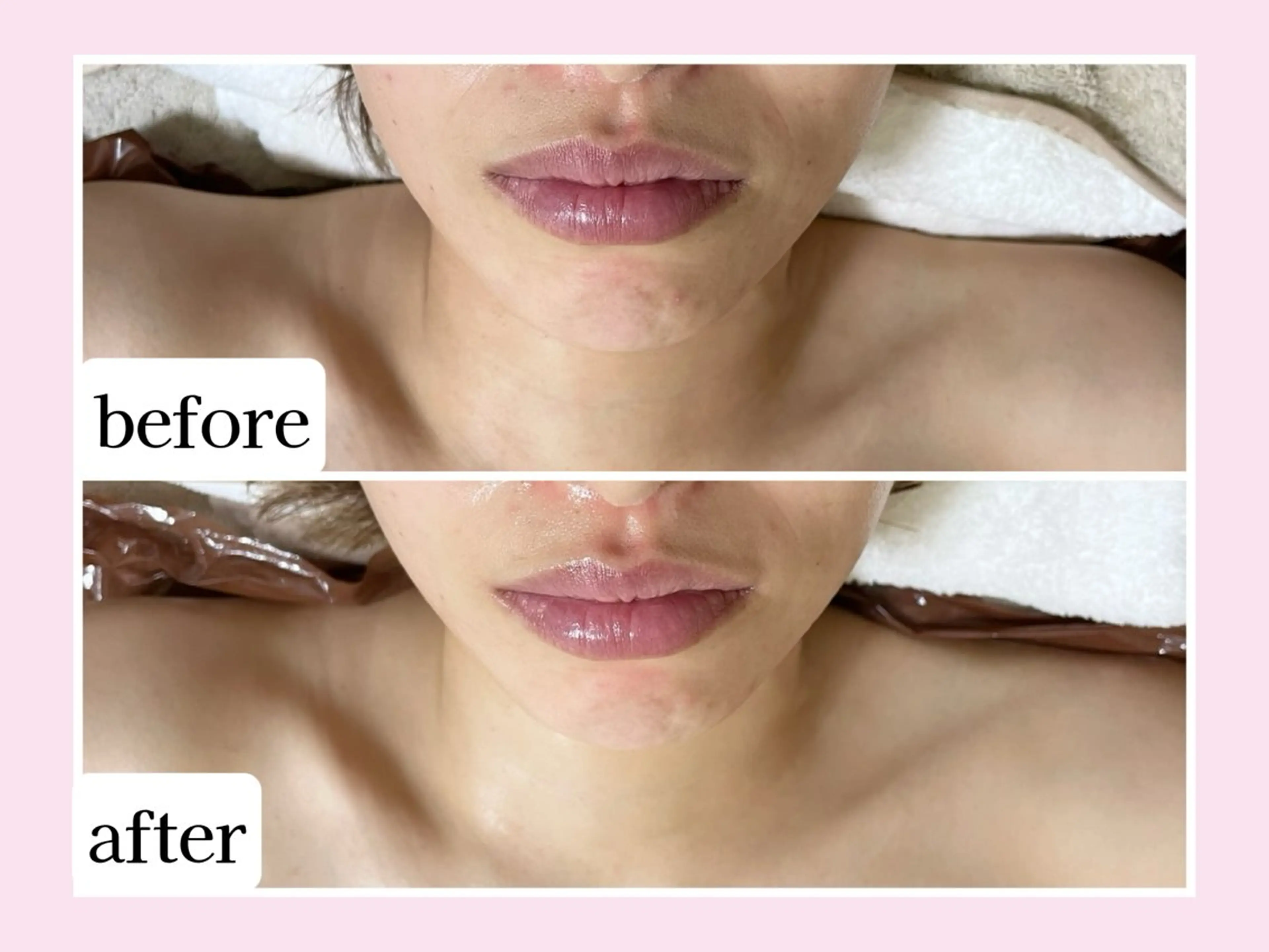 その他 Karen Private Spa所属・💜Karen PrivateSpaのエステ・リラクイメージ