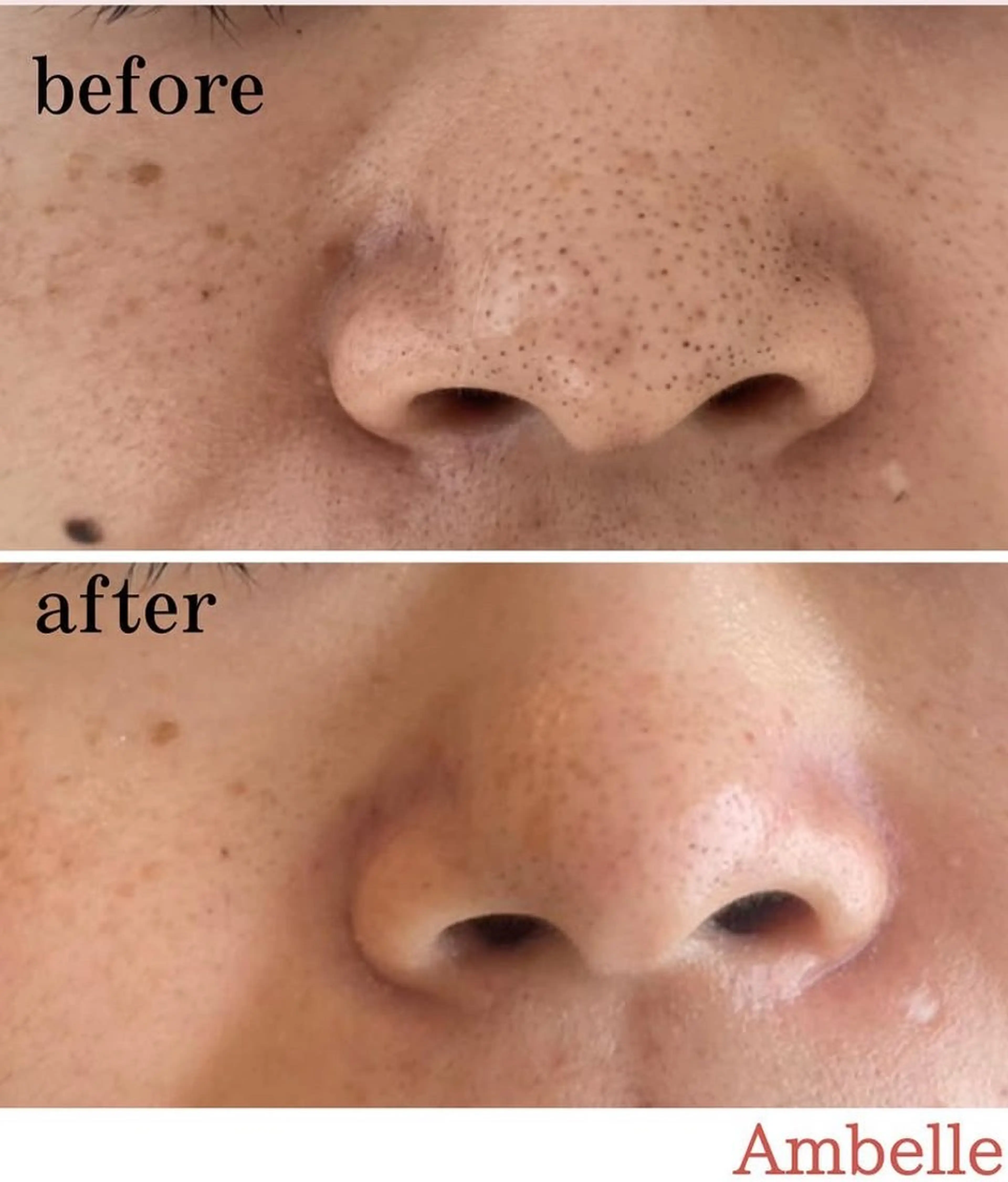 エステ サロン　Ambelle所属・北川 亜友美のエステ・リラクイメージ