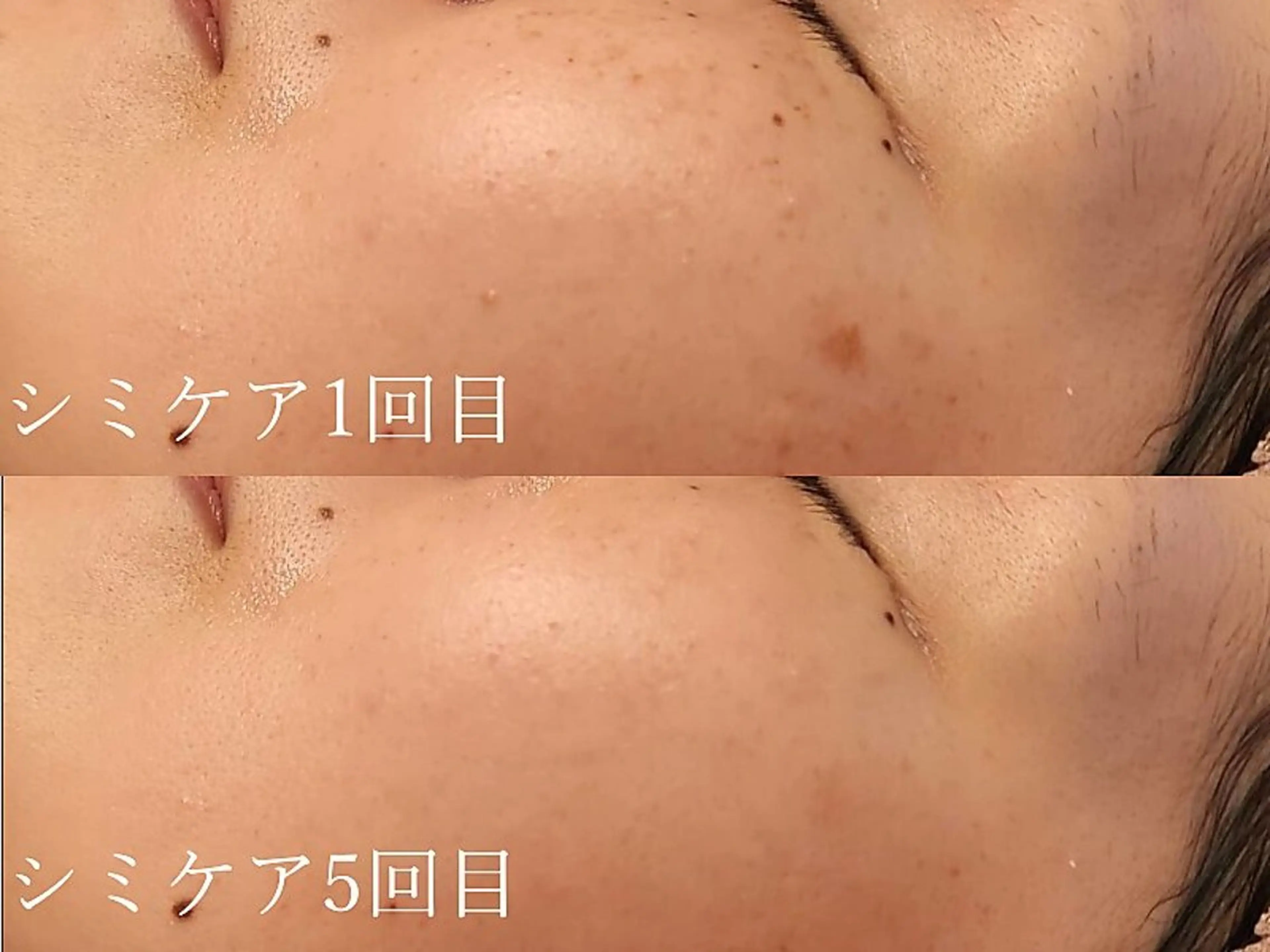 エステ シミたるみケア リラク リタ池尻大橋のエステ・リラクイメージ