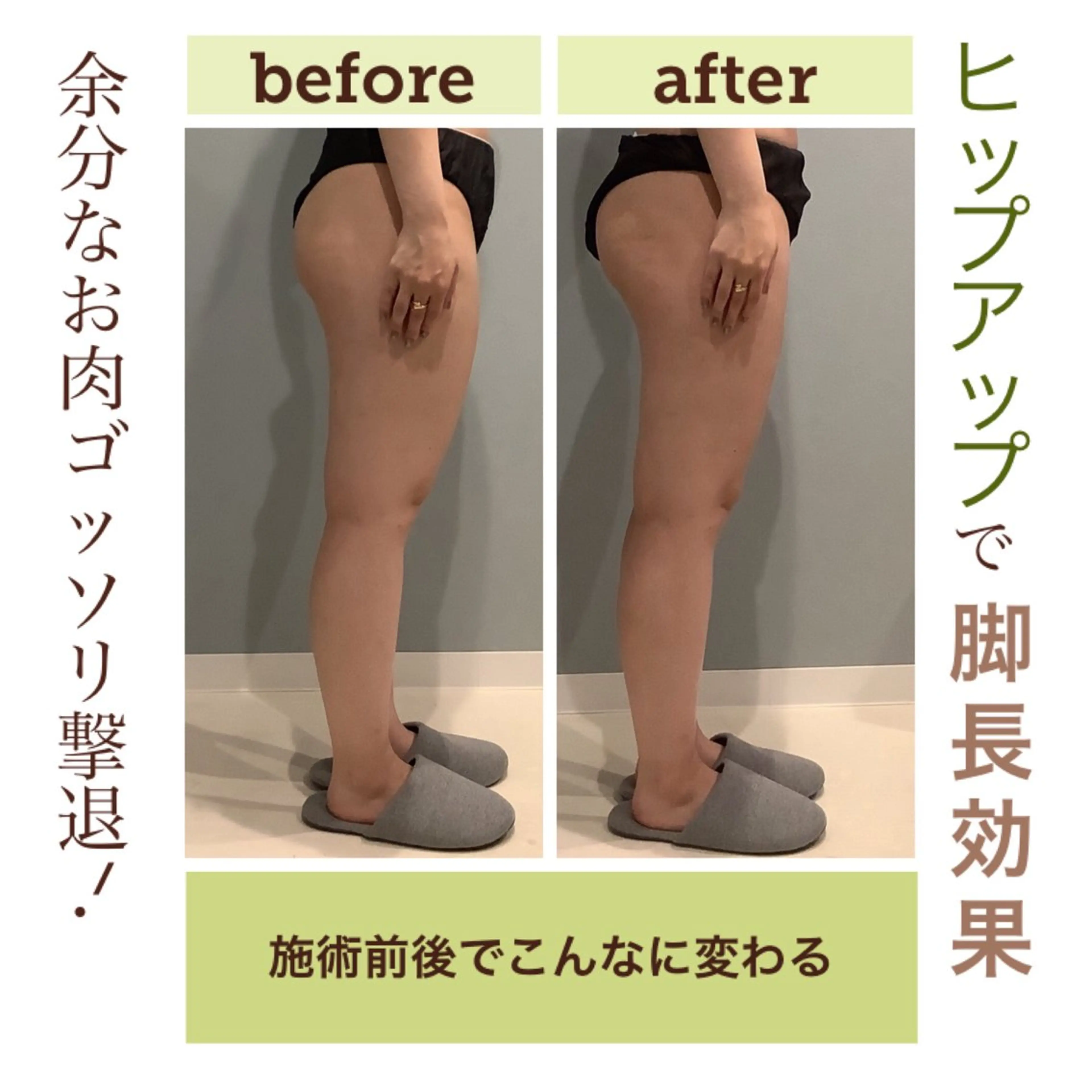 エステ エステサロン JURISのエステ・リラクイメージ