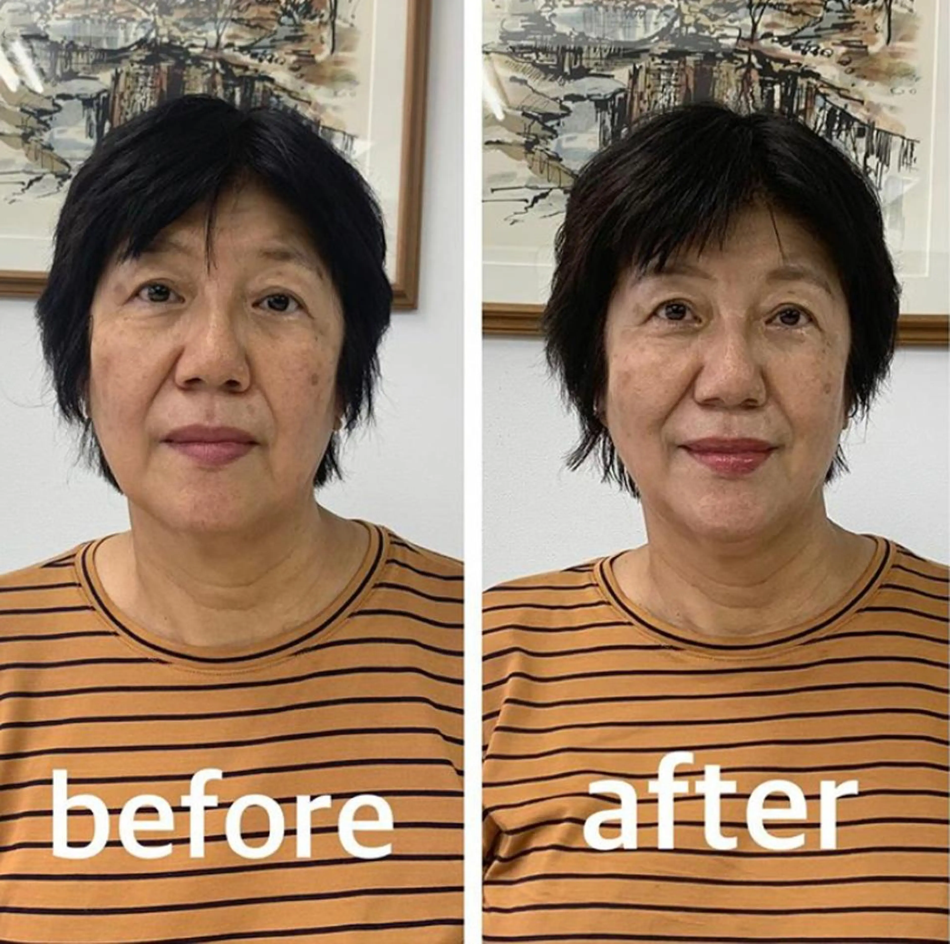 エステ リラク 小顔と ヘッドスパのお店のエステ・リラクイメージ