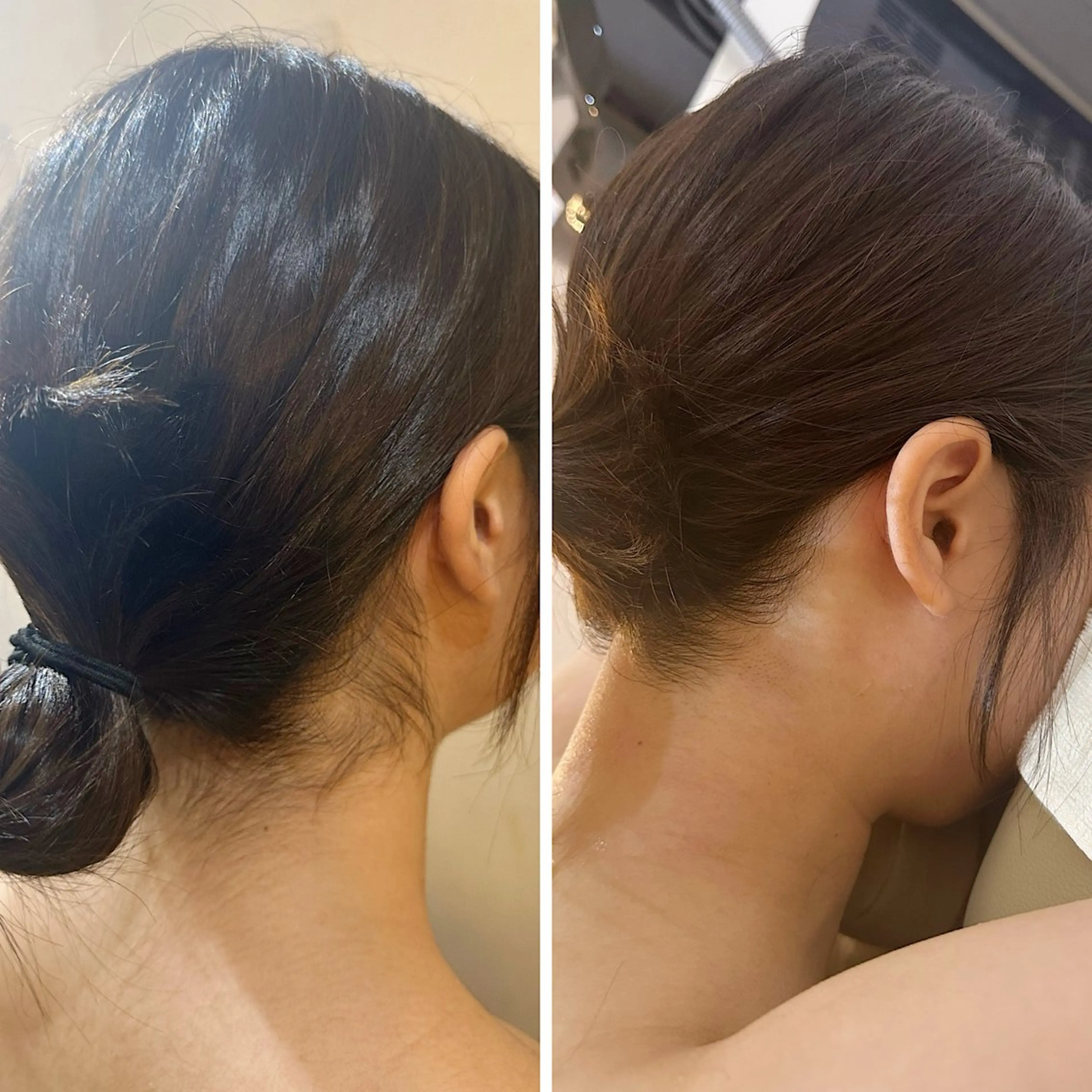 脱毛 うなじ脱毛/美肌脱毛 LABELのエステ・リラクイメージ