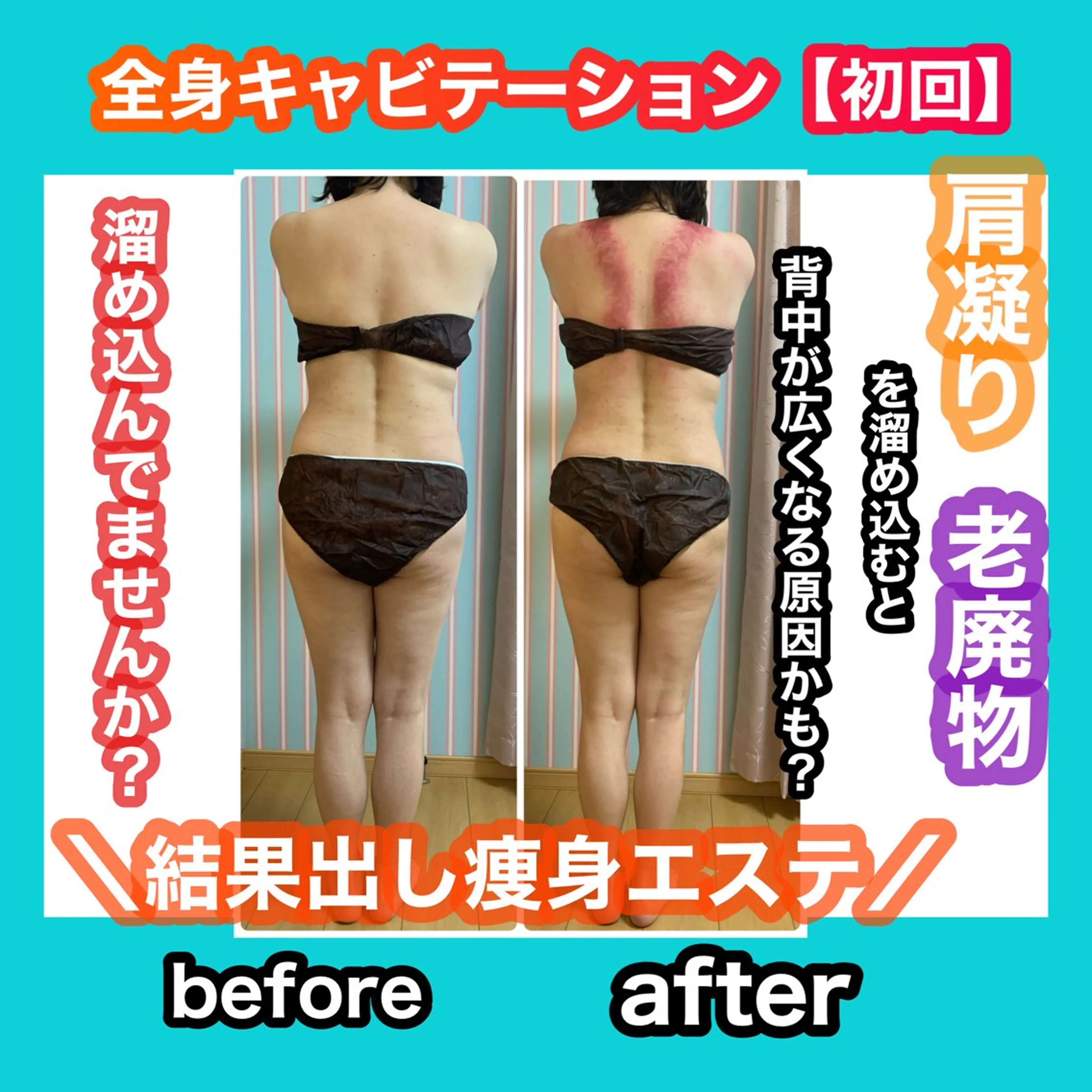 エステ リラク 痩身/脱毛/ネイル HARUKAのエステ・リラクイメージ