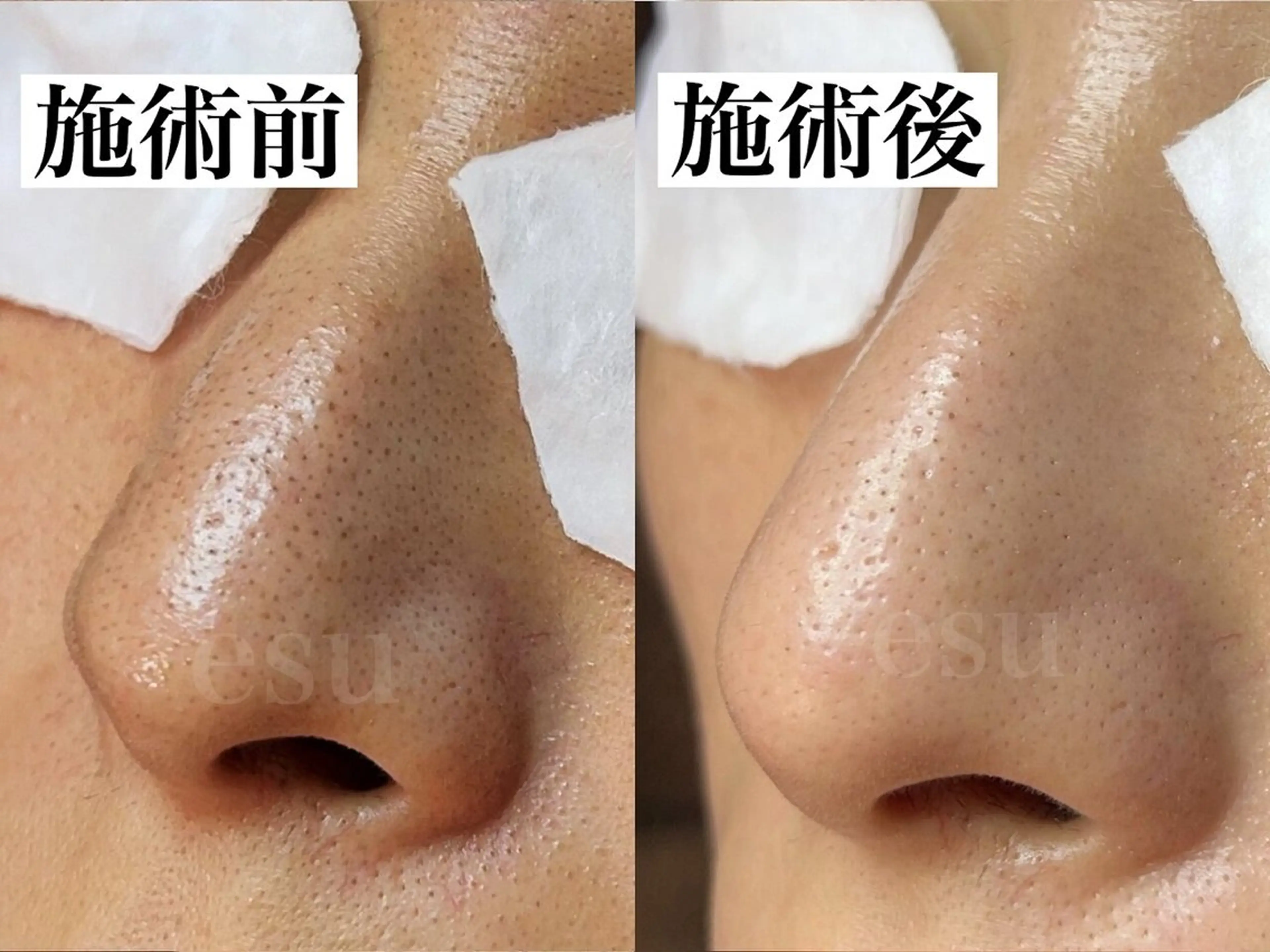 毛穴ケア専門店 esu(エス)のエステ・リラクイメージ