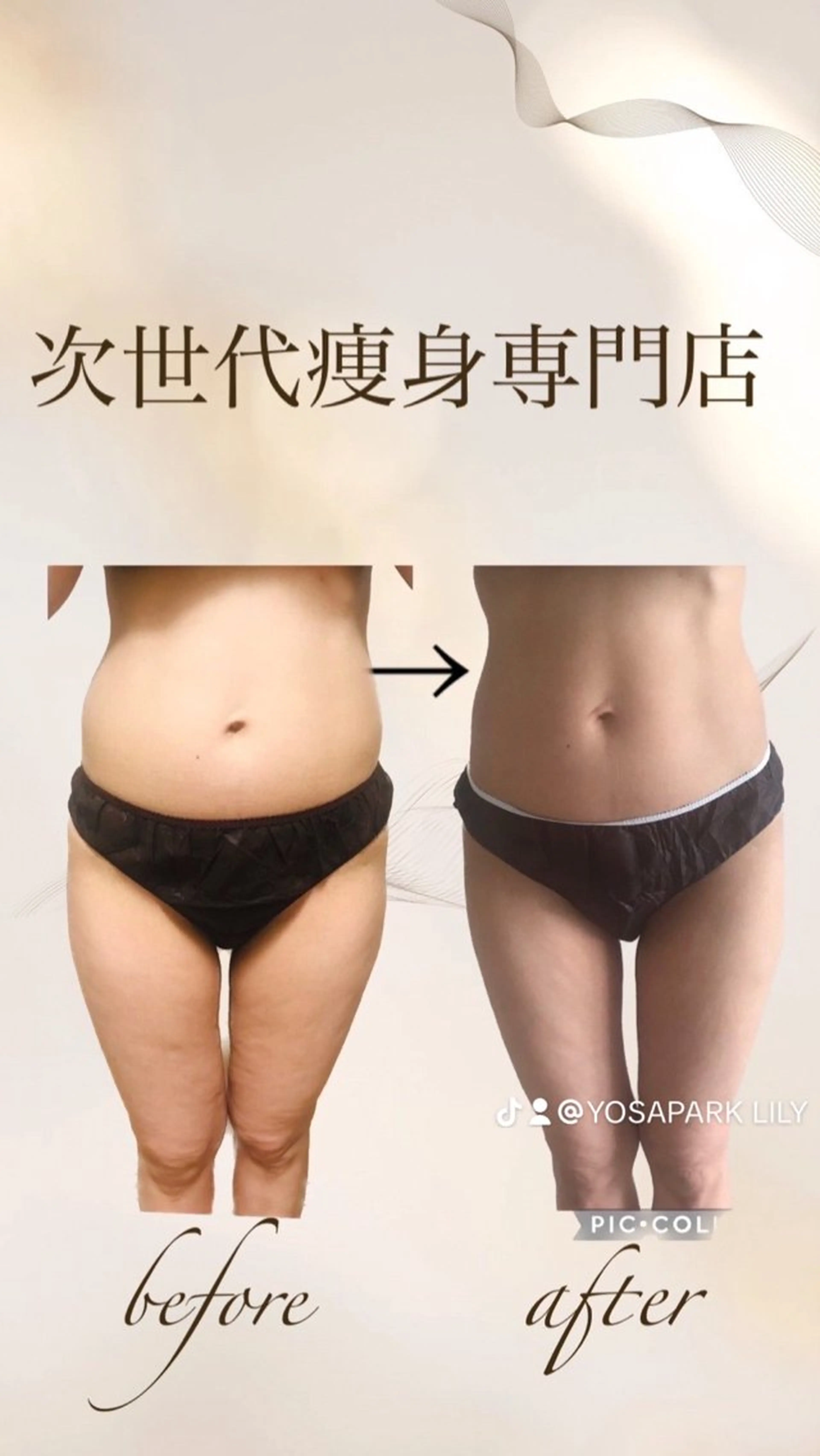 エステ 温活痩身サロン ヨサパークリリーのエステ・リラクイメージ