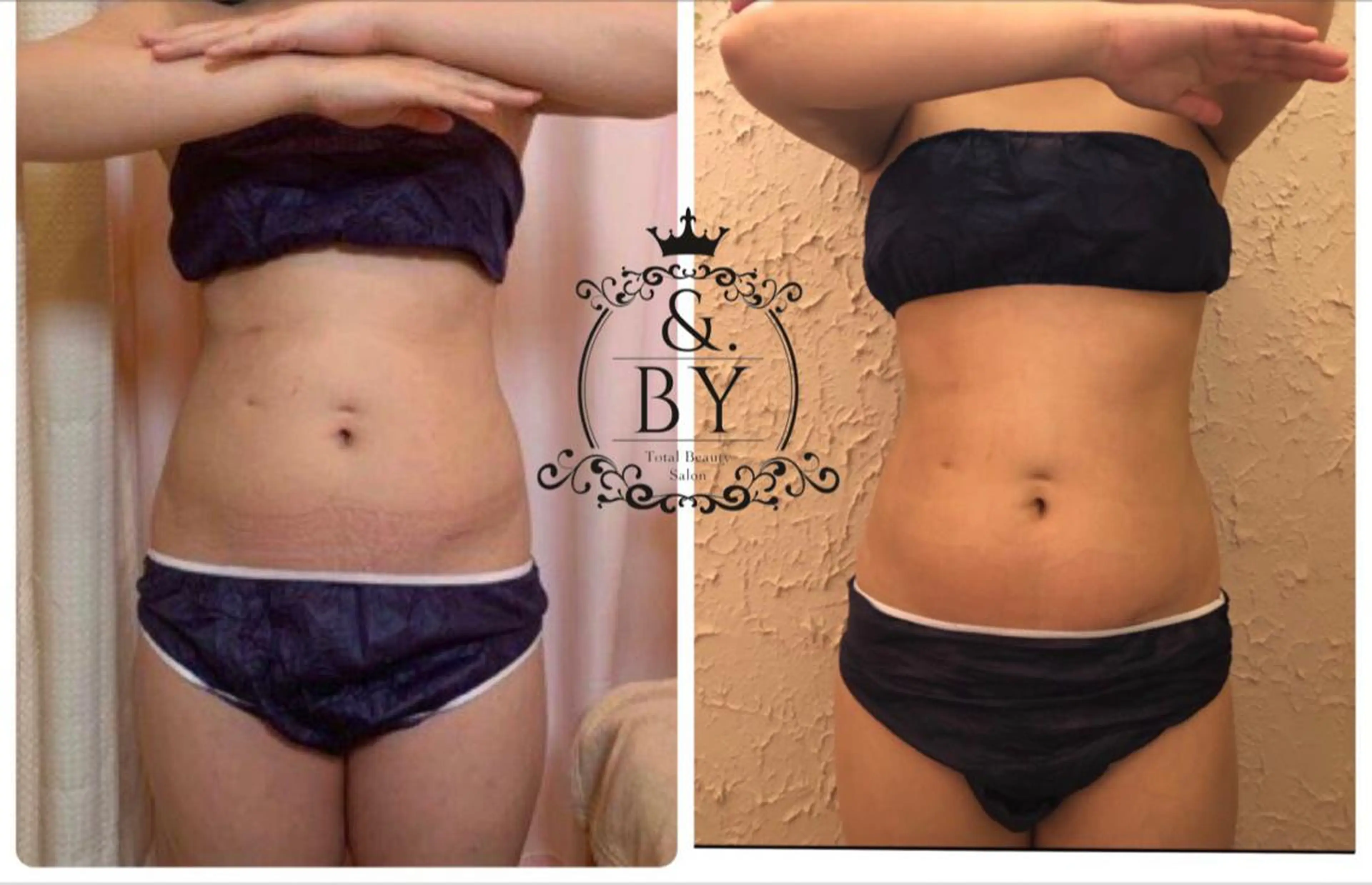 &. BYのエステ・リラクイメージ