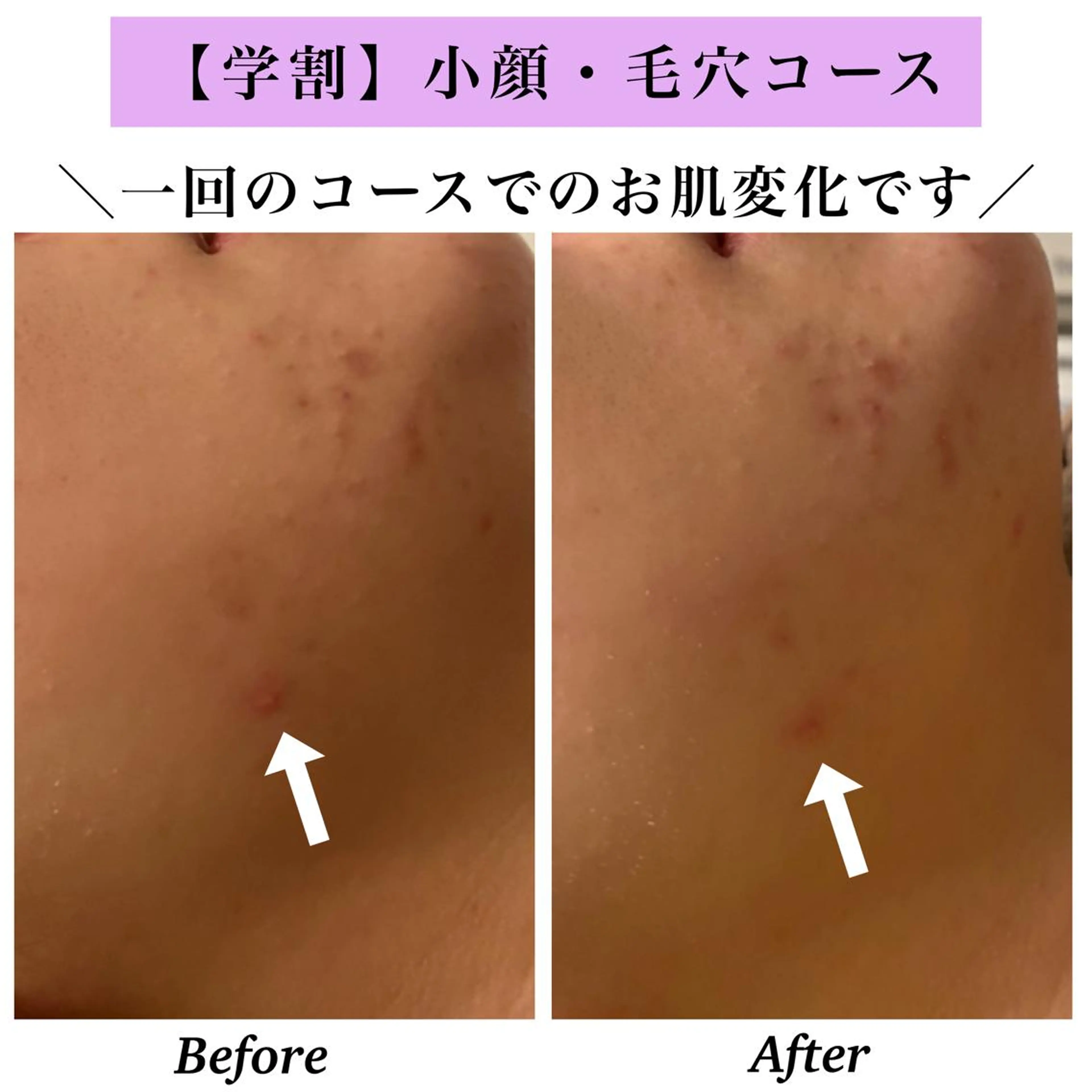 Bellesthe (ベルエステ)のエステ・リラクイメージ