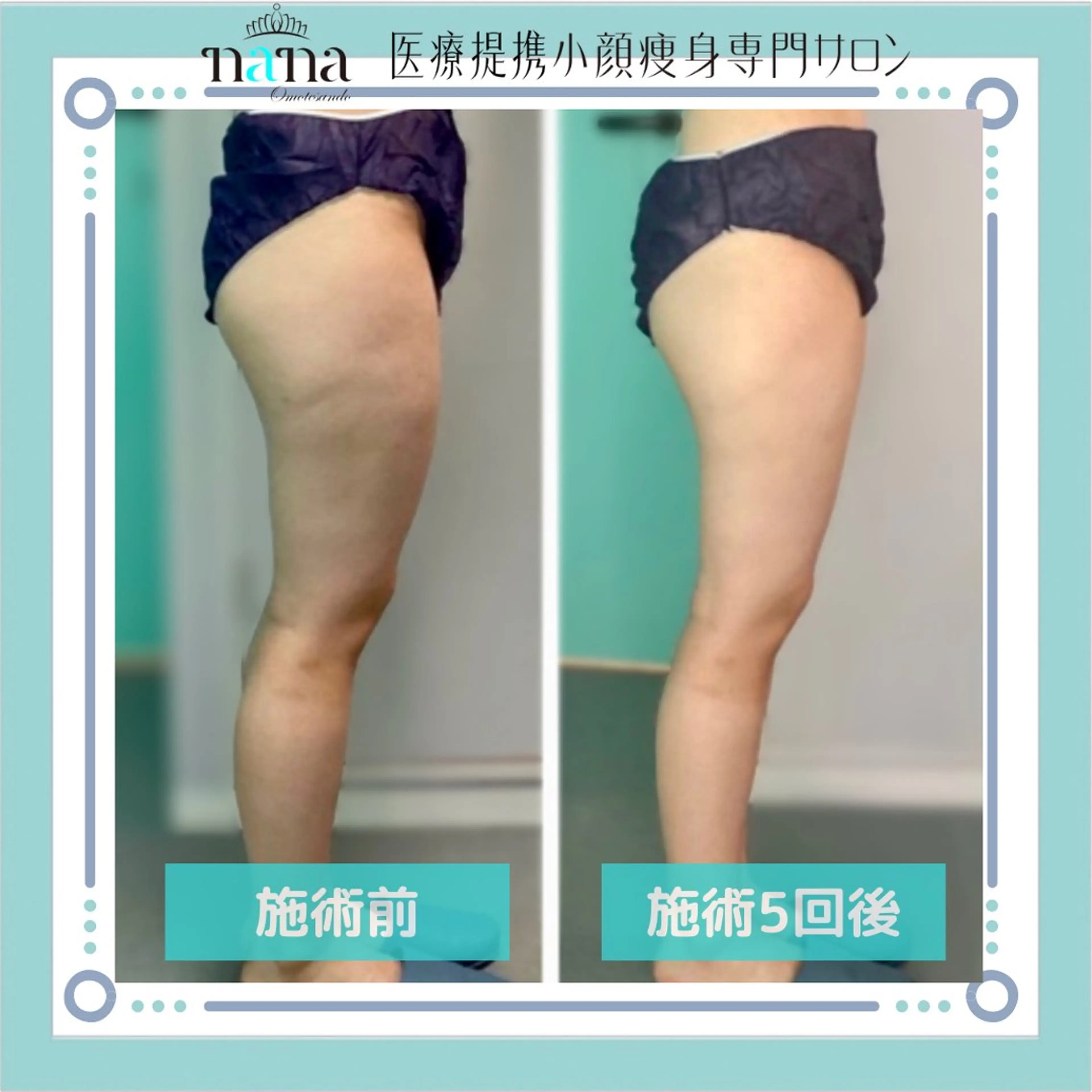 小顔痩身インディバ Nana表参道のエステ・リラクイメージ