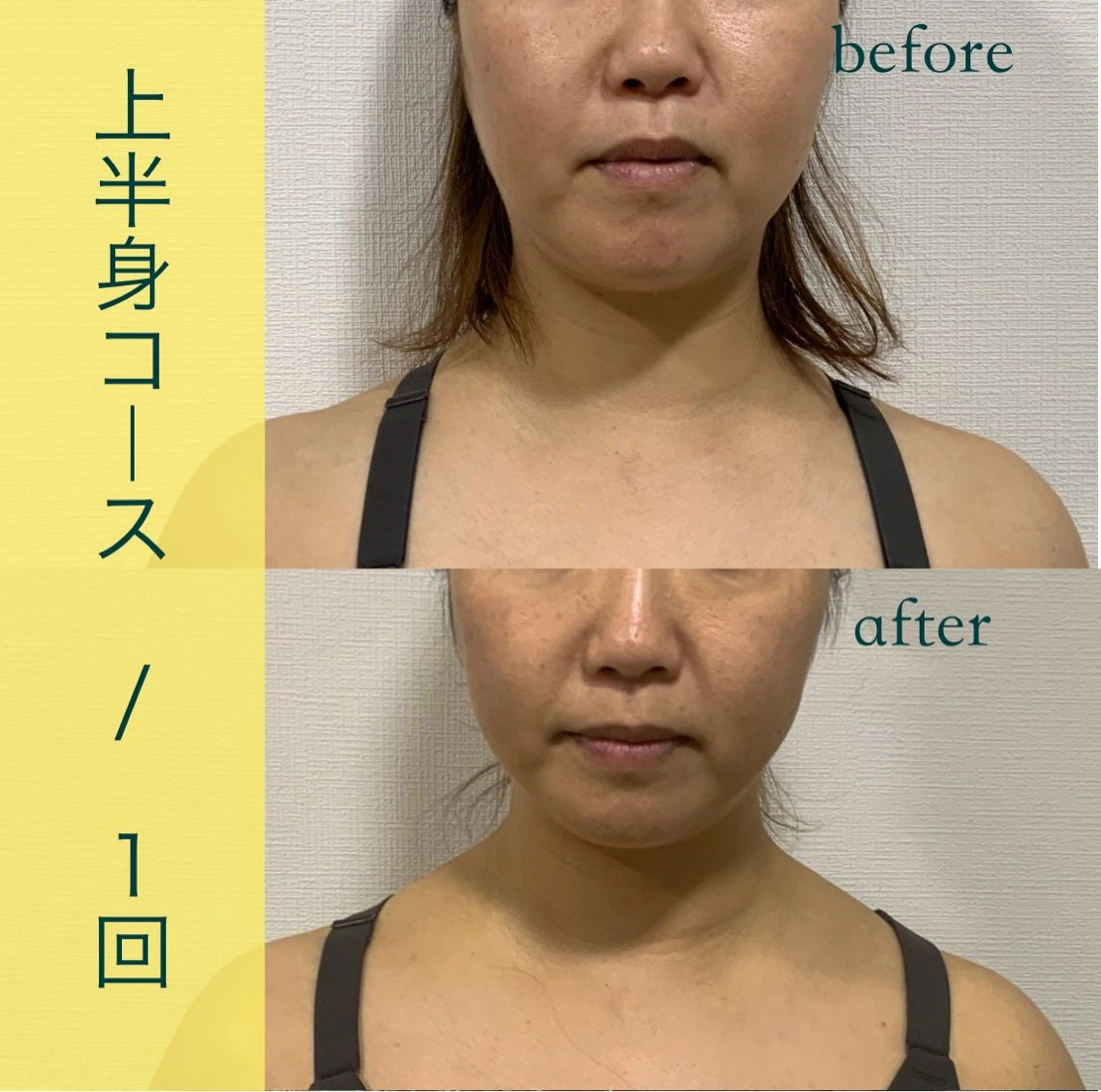 小顔&美容矯正 サロン🌿Miloのエステ・リラクイメージ