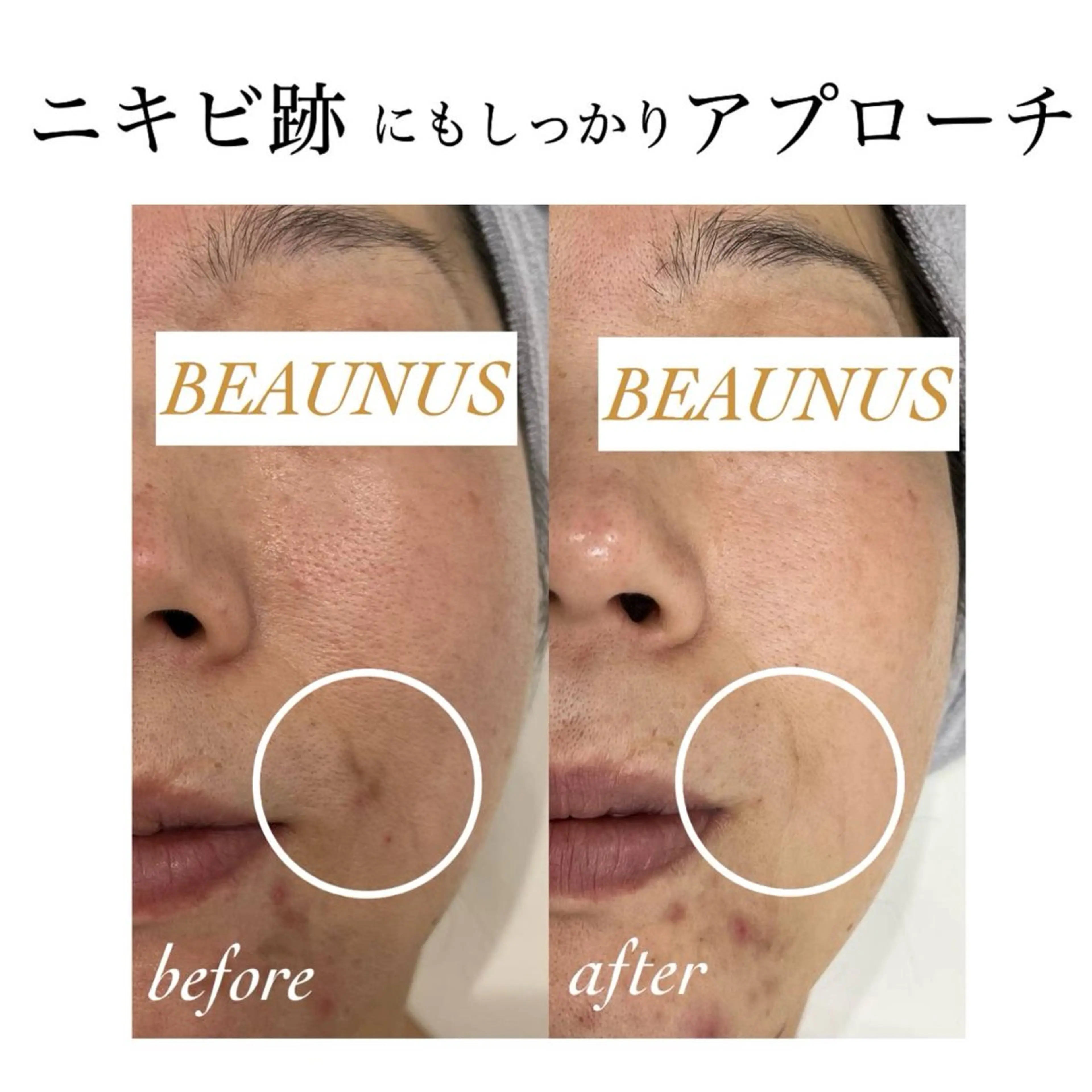 エステ BEAUNUS所属・シミケア専門店 BEAUNUSのエステ・リラクイメージ