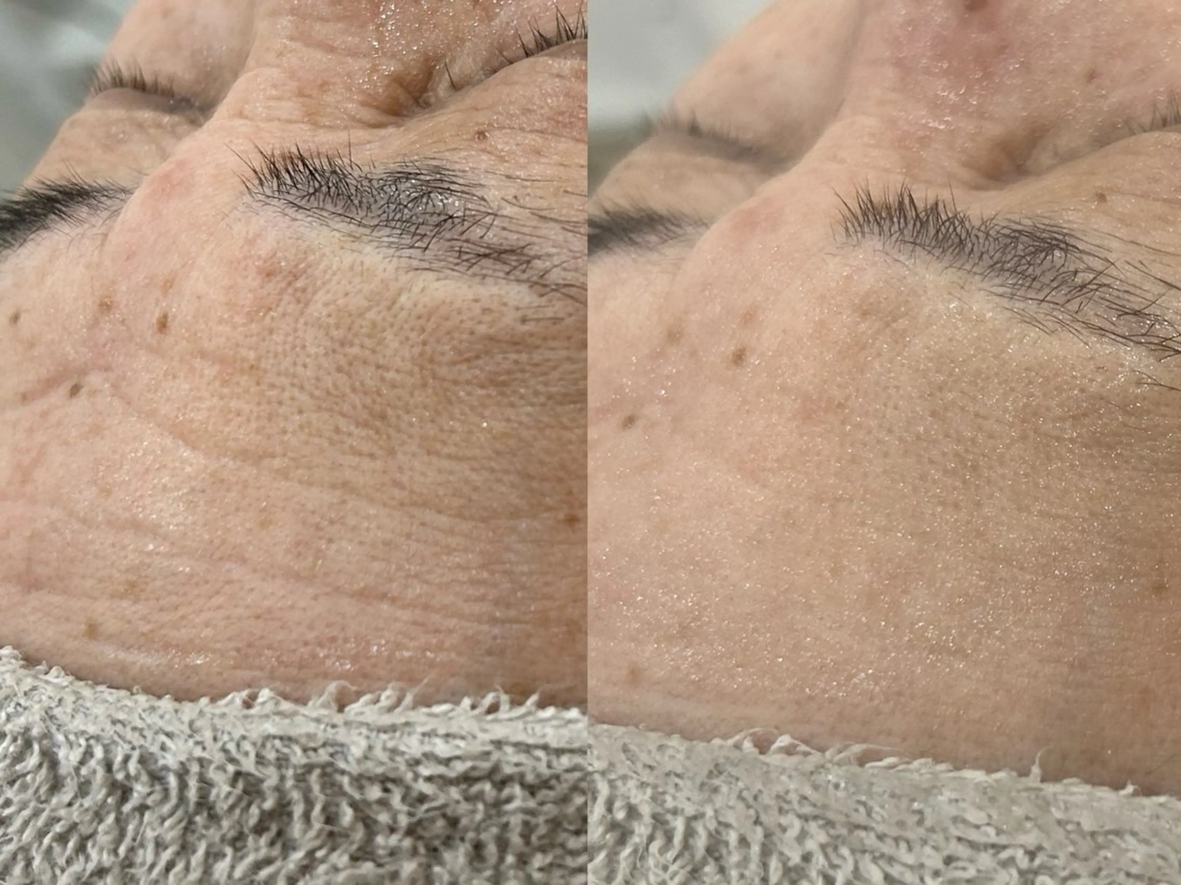 エステ Lyraile所属・-Lyraile - Sahoのエステ・リラクイメージ