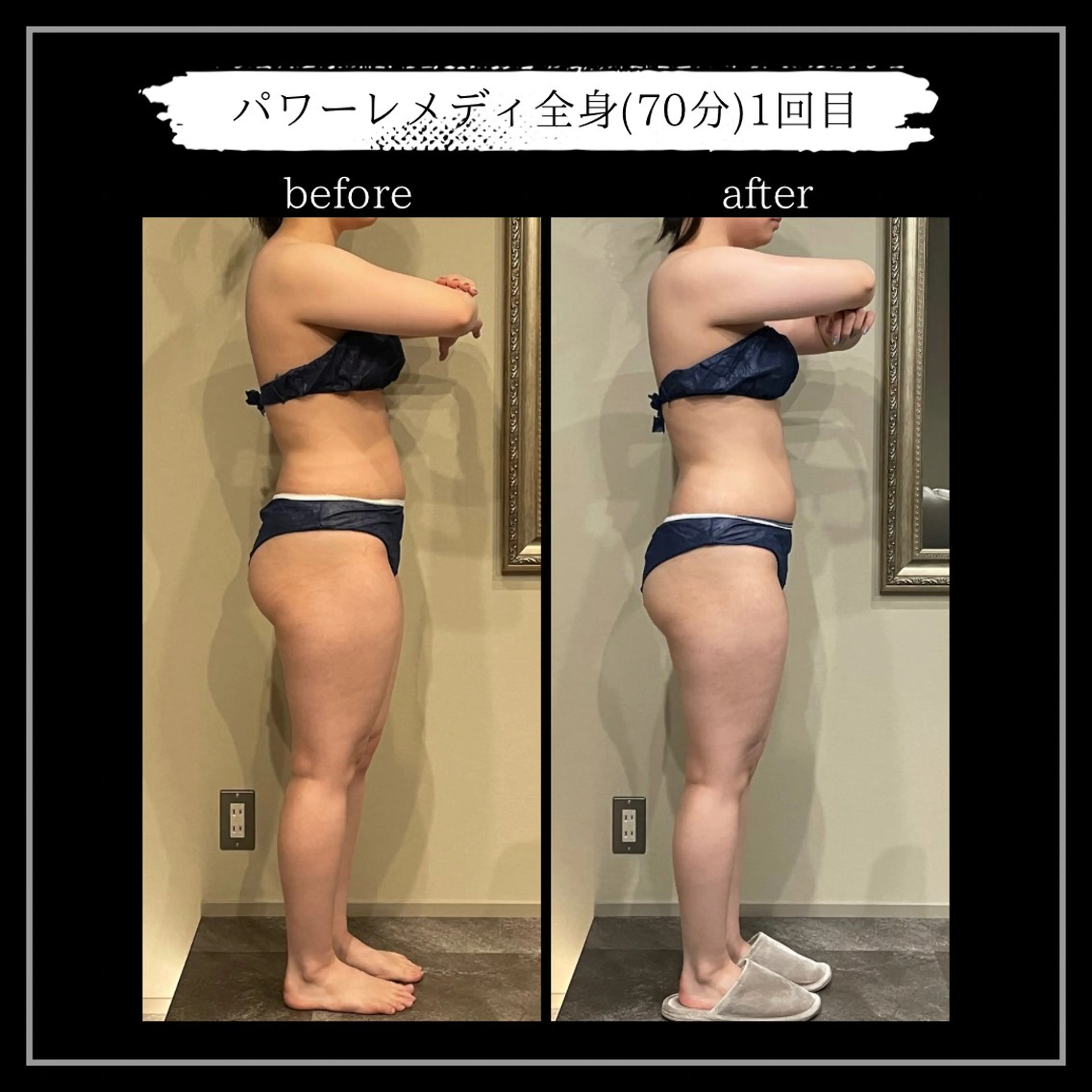 オフ:オン所属・オフ:オン 全身筋膜マッサージのエステ・リラクイメージ