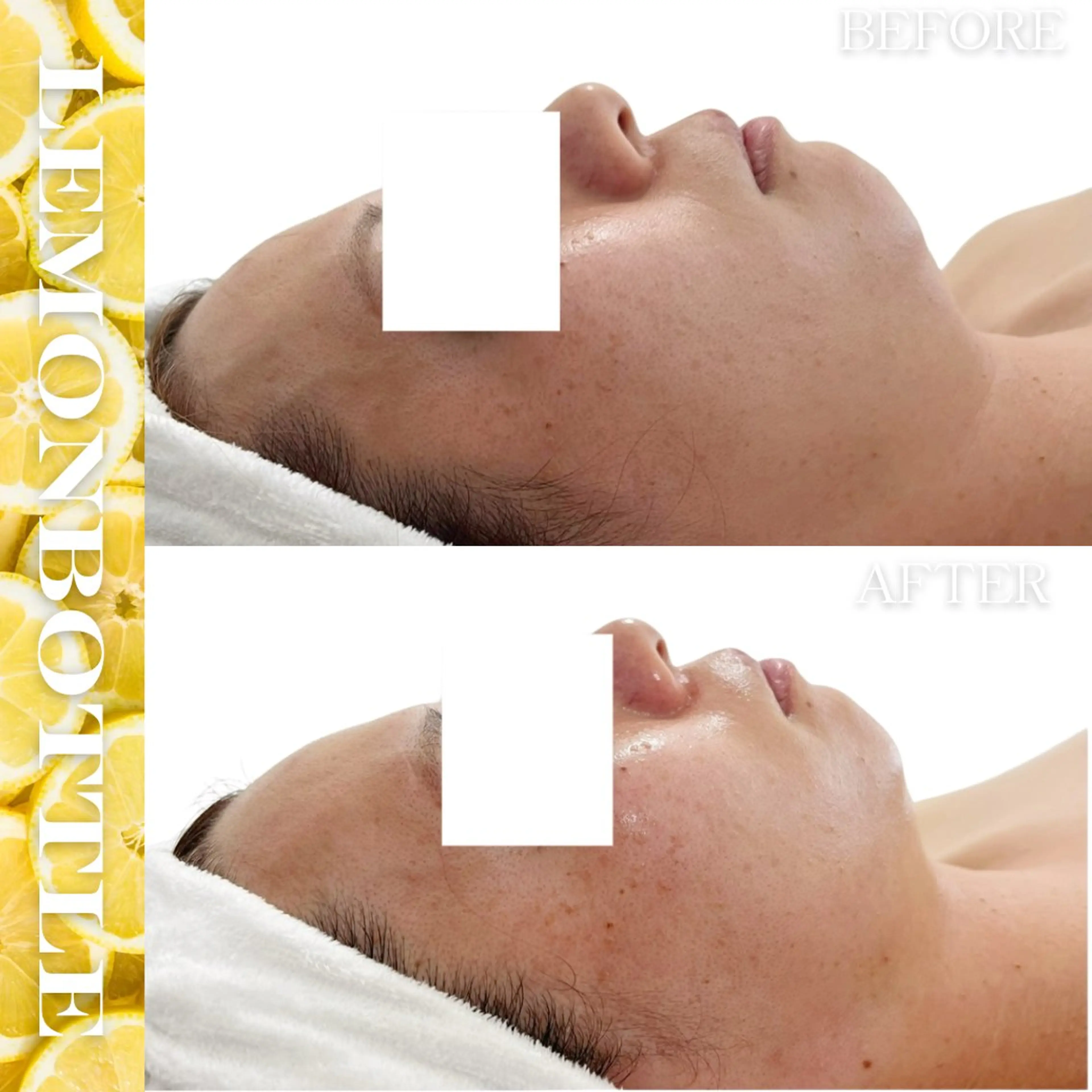 Liam《美肌管理/ 3D小顔/脂肪ケア》のその他イメージ