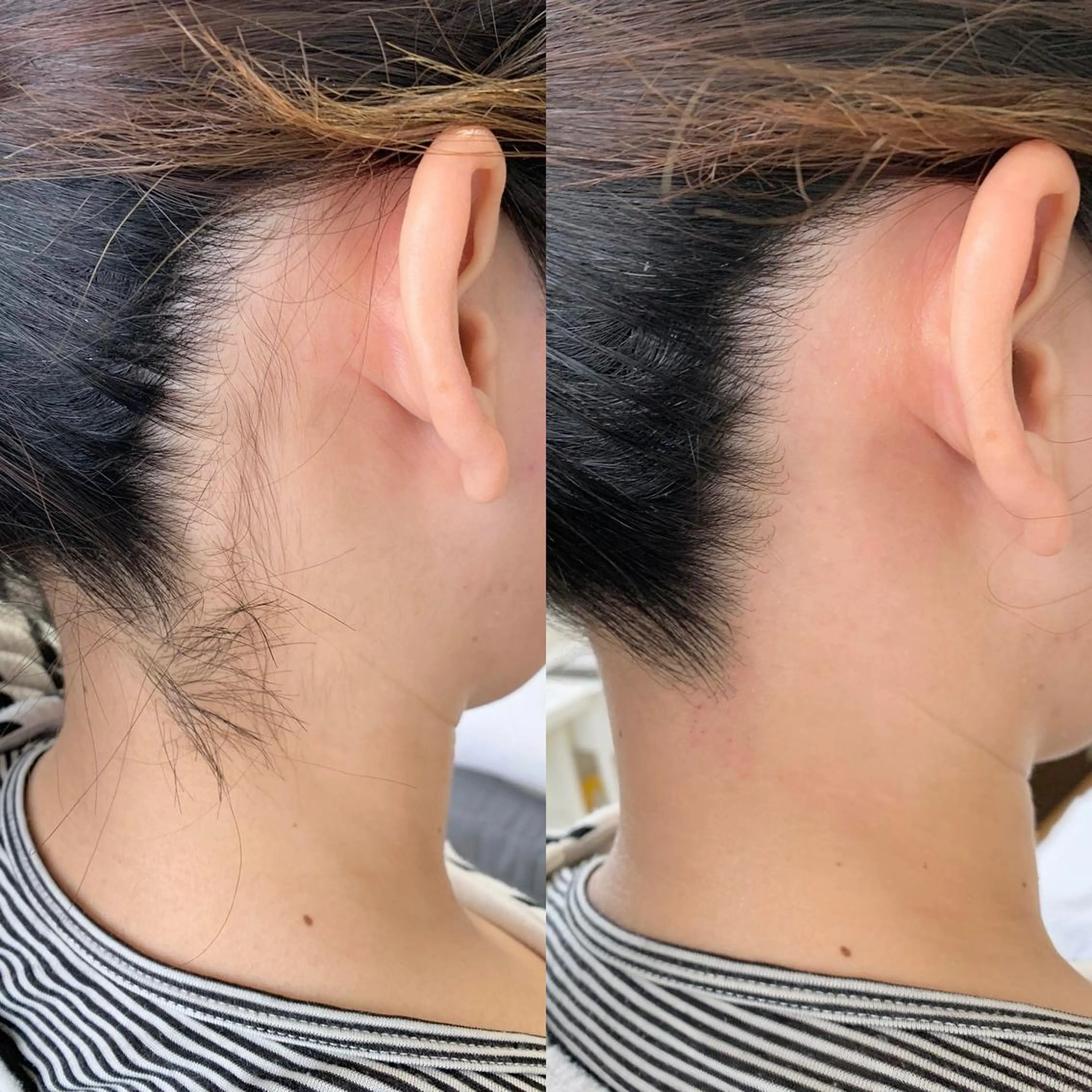 メンズ 脱毛 salonLADYSTYLE所属・稲嶺 美華のエステ・リラクイメージ