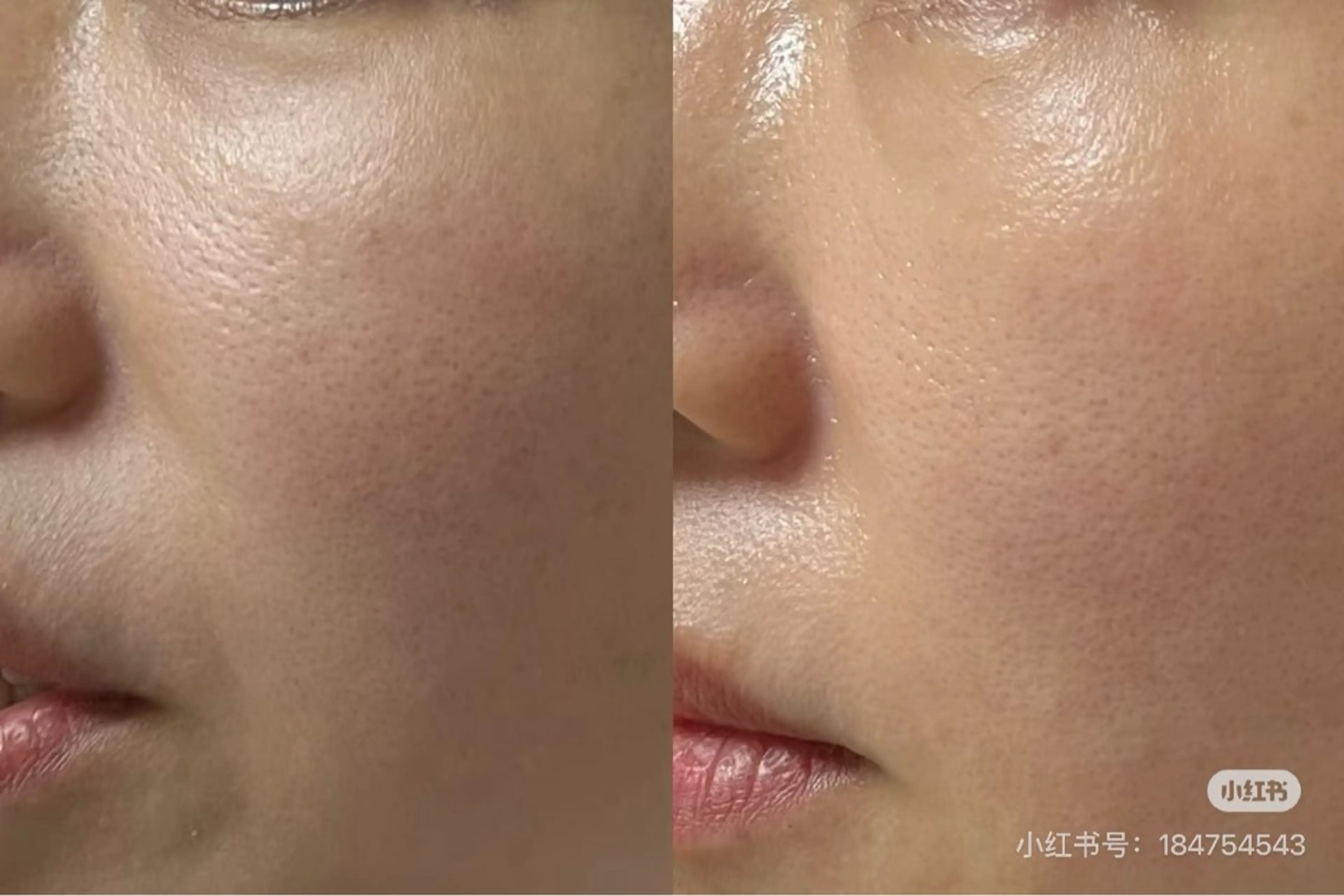 ショート aliaハイフ&水光ジェットサロン所属・aliaハーブ水光店 エステティシャン募集のエステ・リラクイメージ