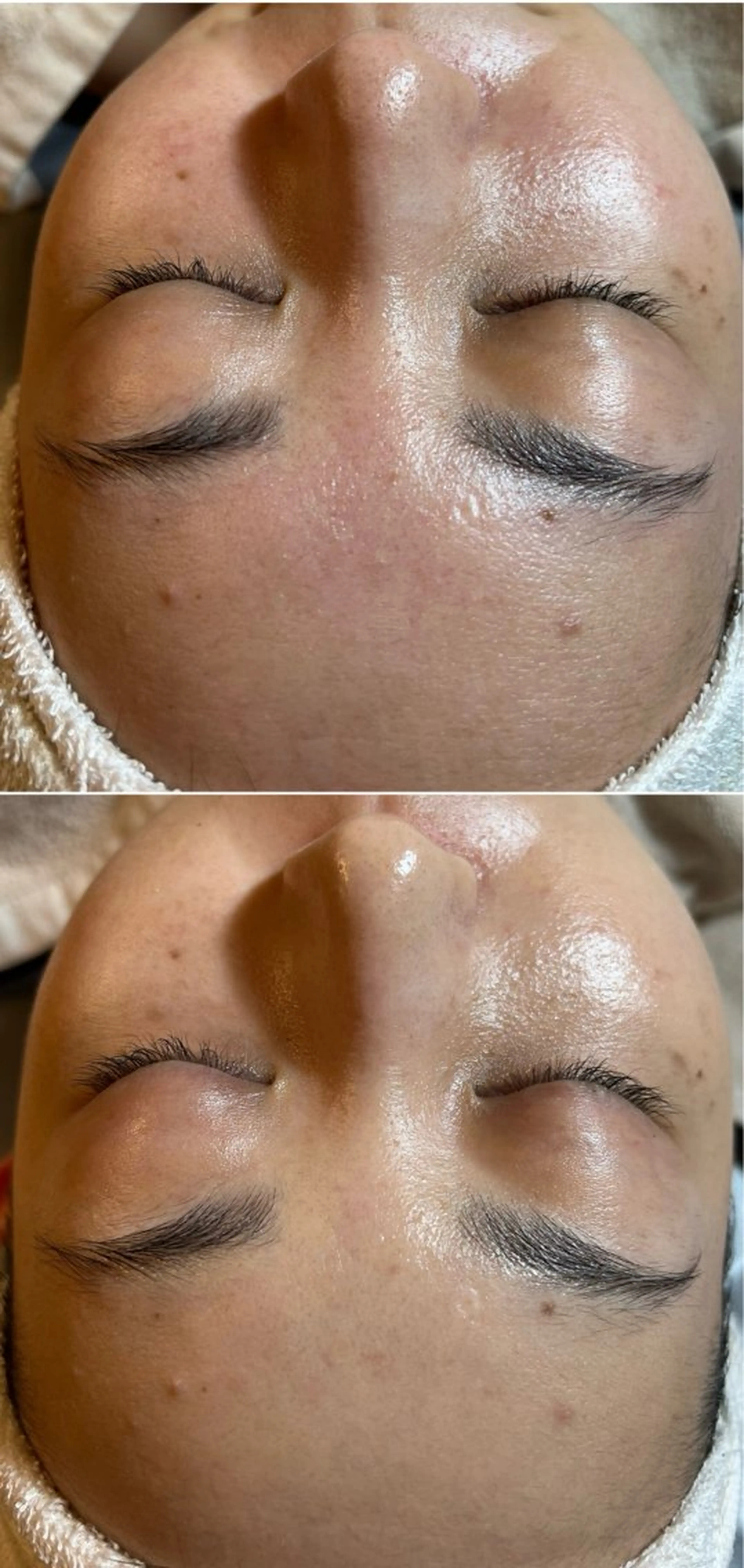 esty hitomiのエステ・リラクイメージ