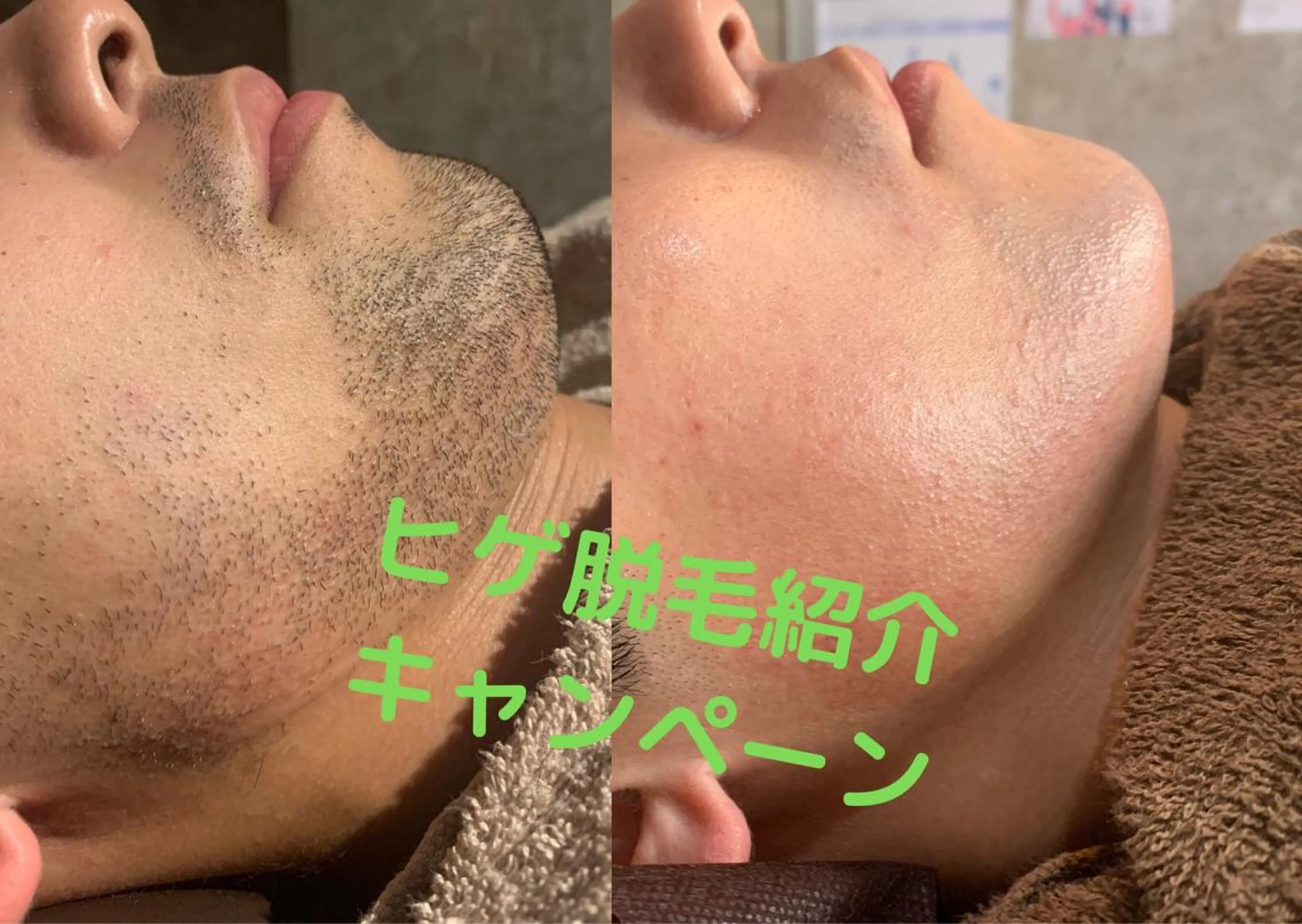 メンズ 20代から始める脱毛 salonLEPIAのエステ・リラクイメージ