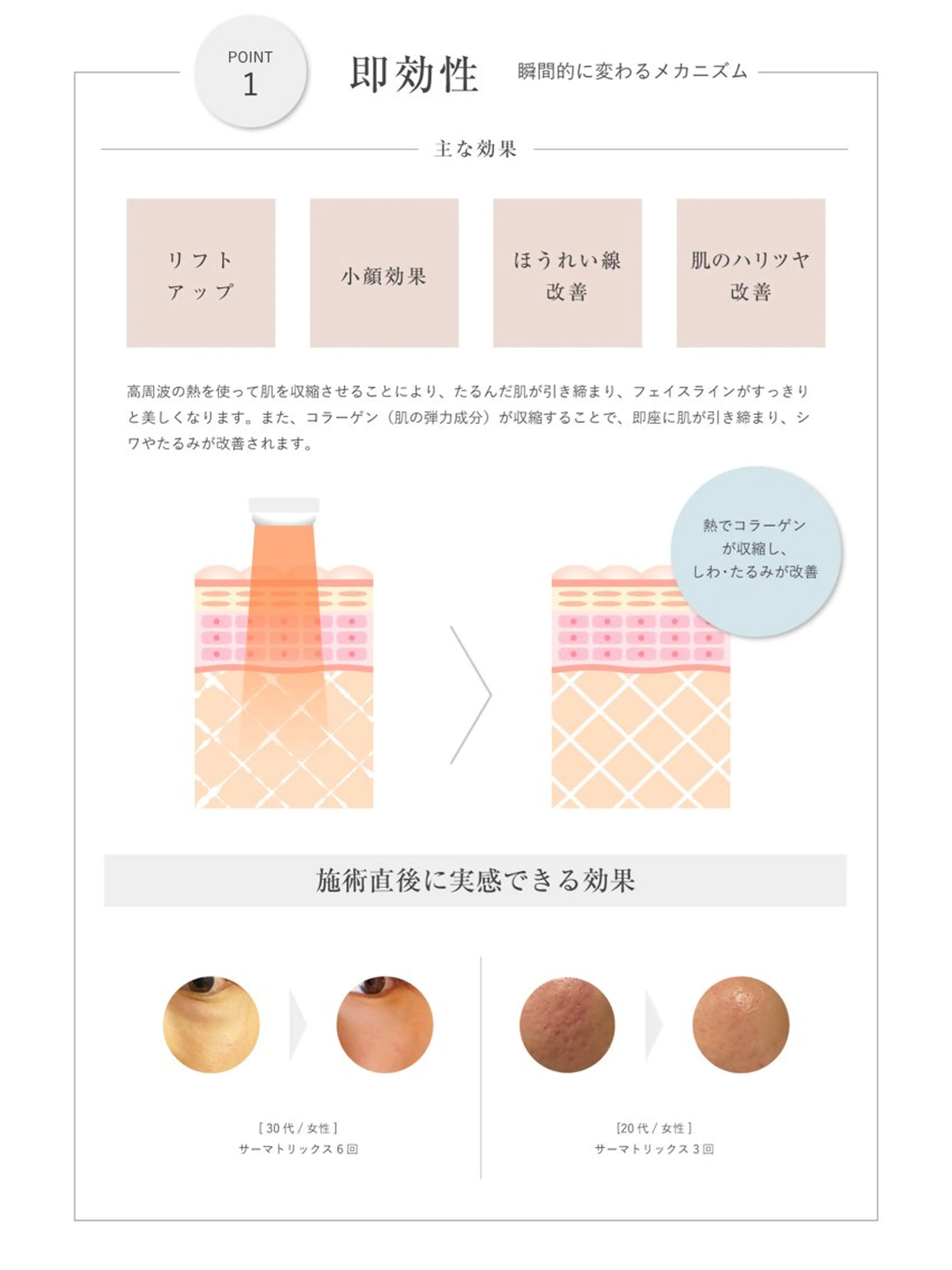 ⭐️リフトアップ効果実感/お試し価格⭐️【サーマトリックス/オリジオ同様効果】しわたるみ改善！お好きな部位3パーツ💎の写真
