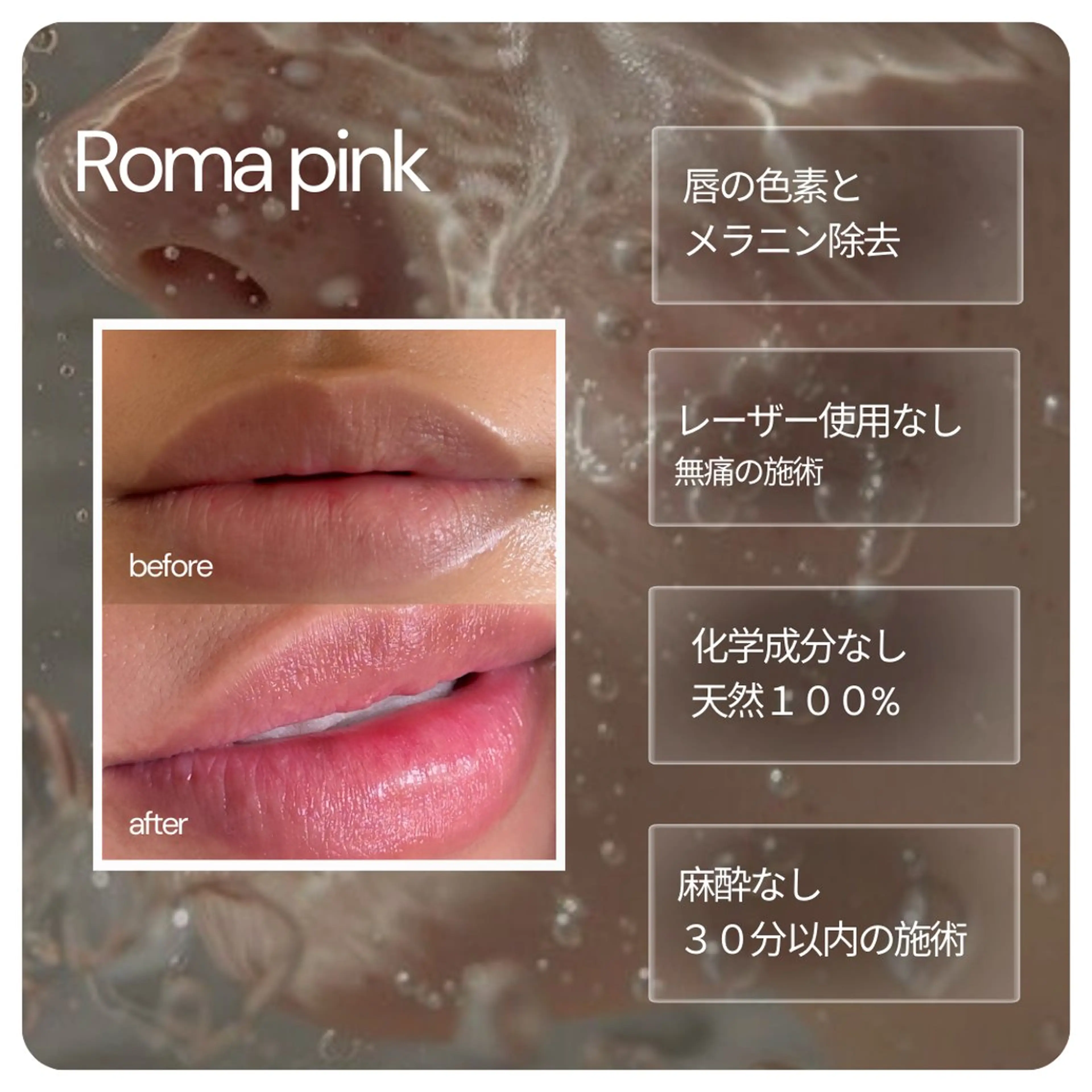 小顔/たるみ/黒ずみ除去専門サロン/SONA 大和西大寺店所属・【小顔専門看護師 サロンSONA】のエステ・リラクイメージ