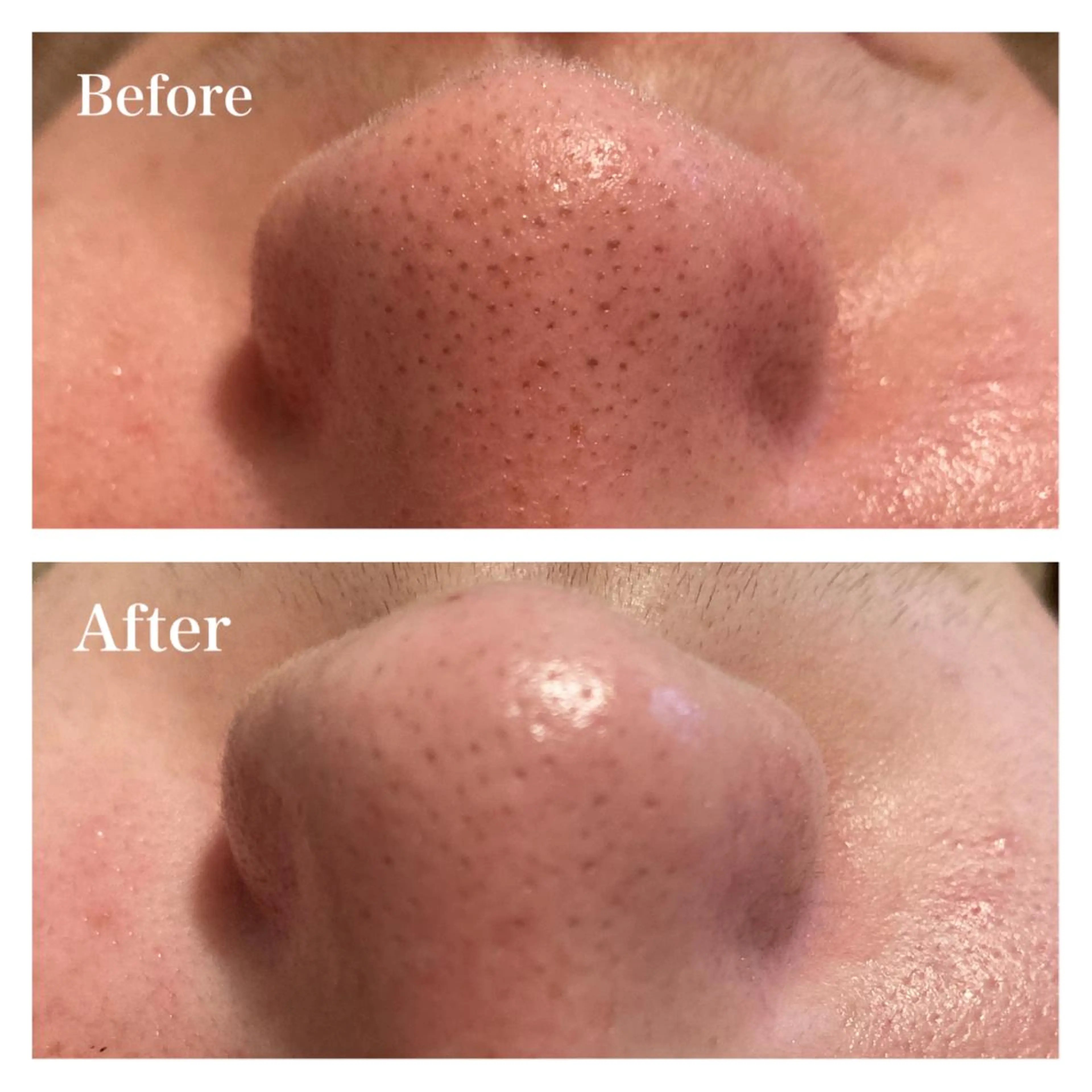 B&H所属・頭痛•肩こり専門/ 眉サロンB&H心斎橋のエステ・リラクイメージ