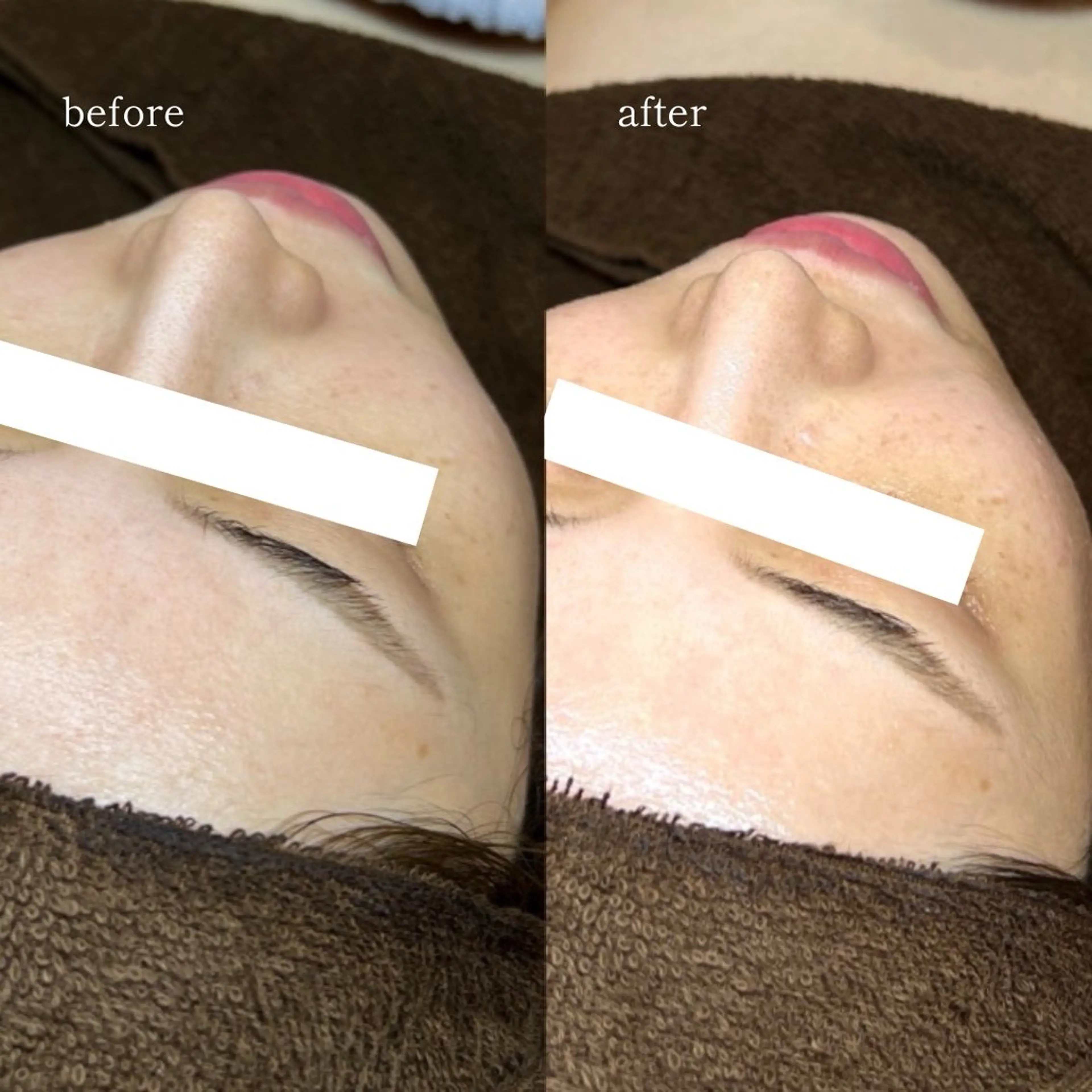 エステ EARNEST大阪 心斎橋【韓国肌管理】のエステ・リラクイメージ