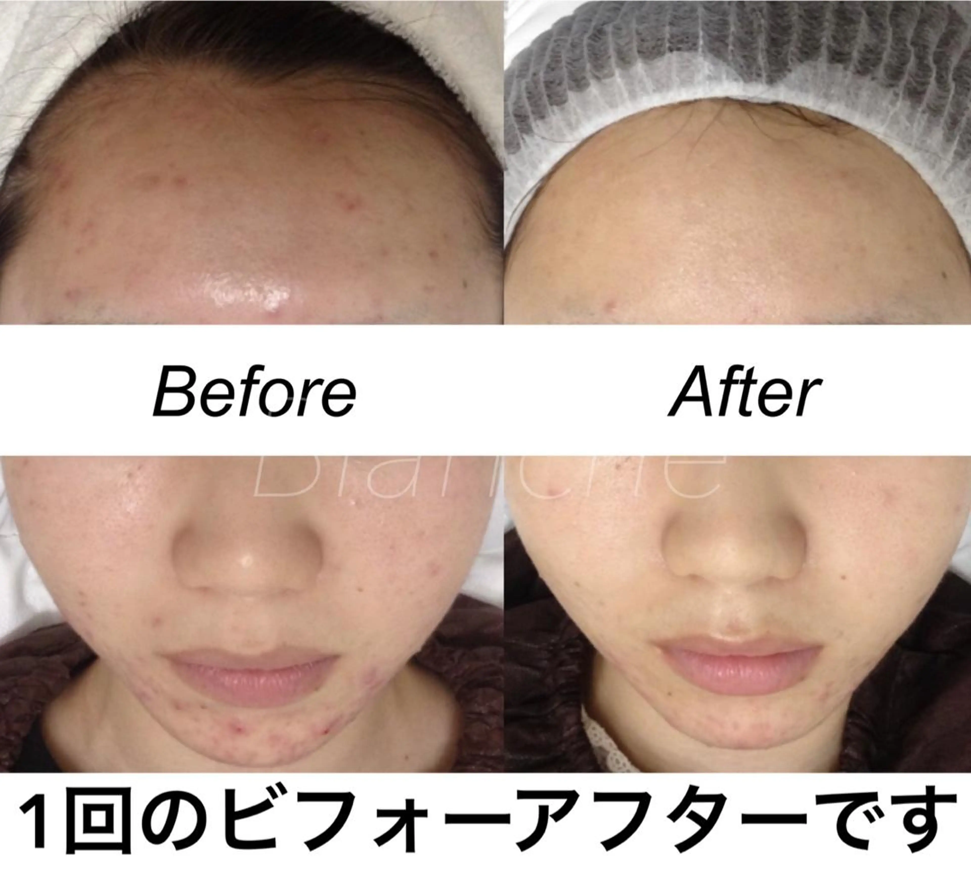 ショート カラー パーマ ネイル マツエク・マツパ エステ リラク 都度払い肌質改善 &脱毛Blancheのエステ・リラクイメージ