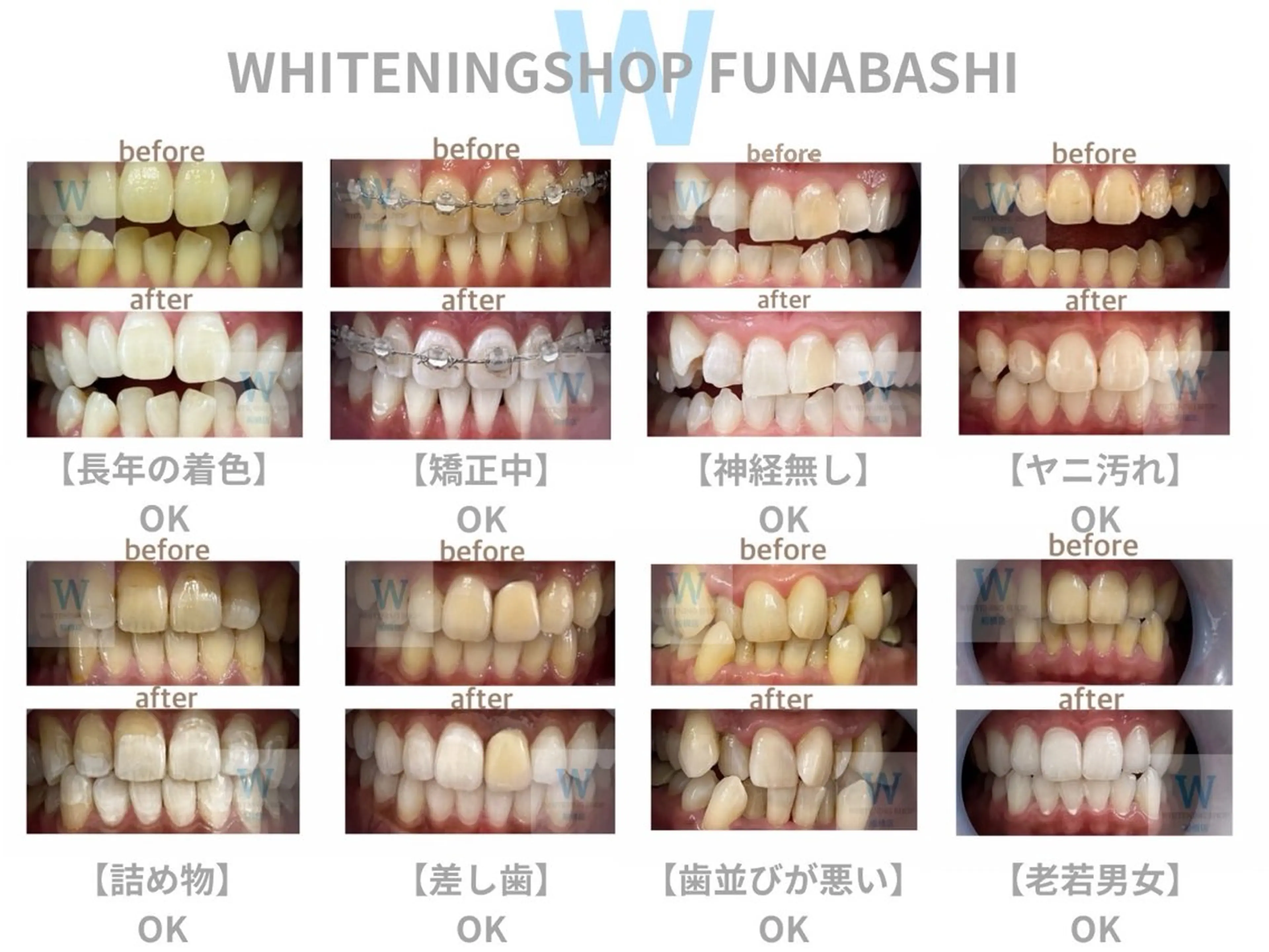 メンズ エステ リラク ホワイトニング ショップ本八幡店のエステ・リラクイメージ