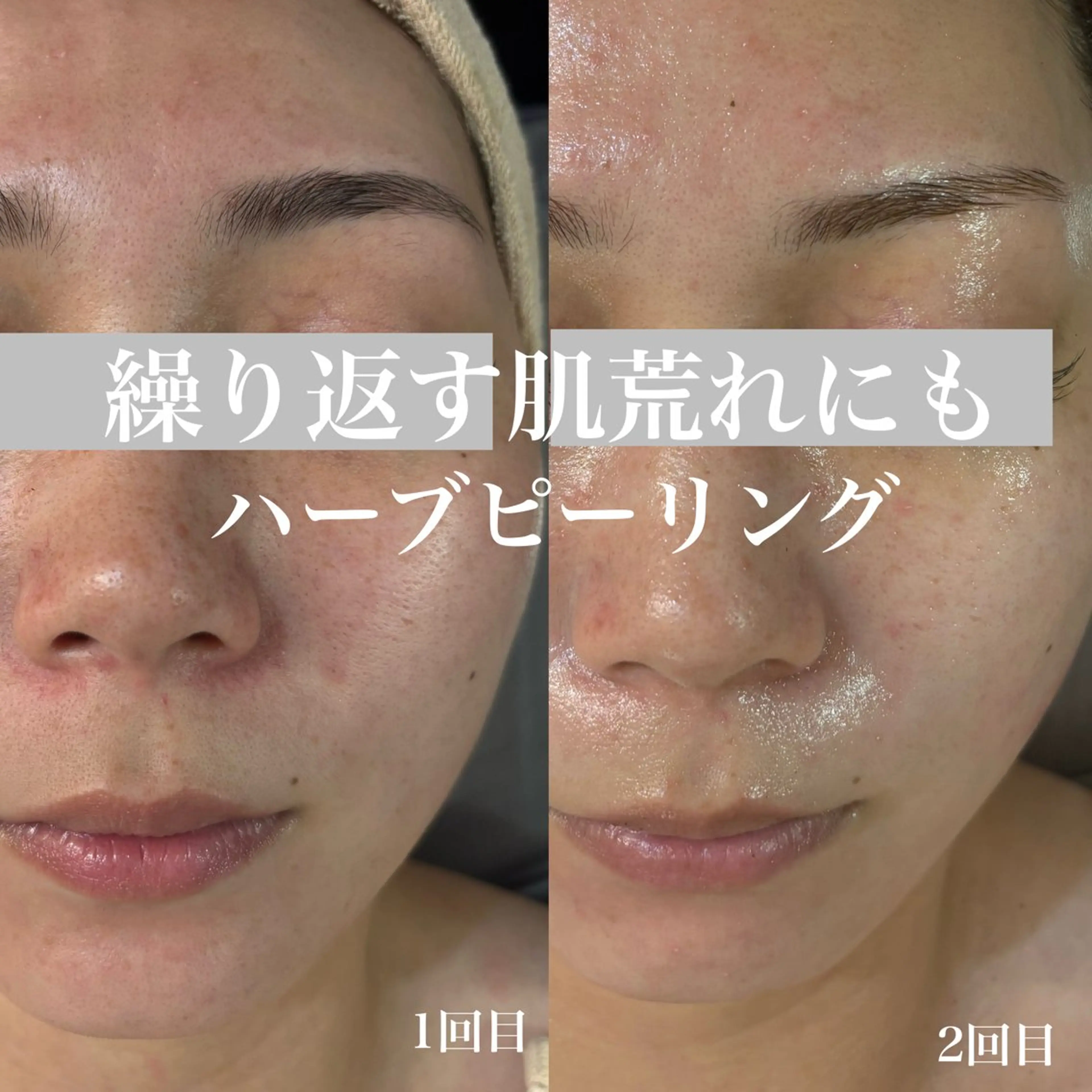 エステ WHITE AQUA 北千住店のエステ・リラクイメージ