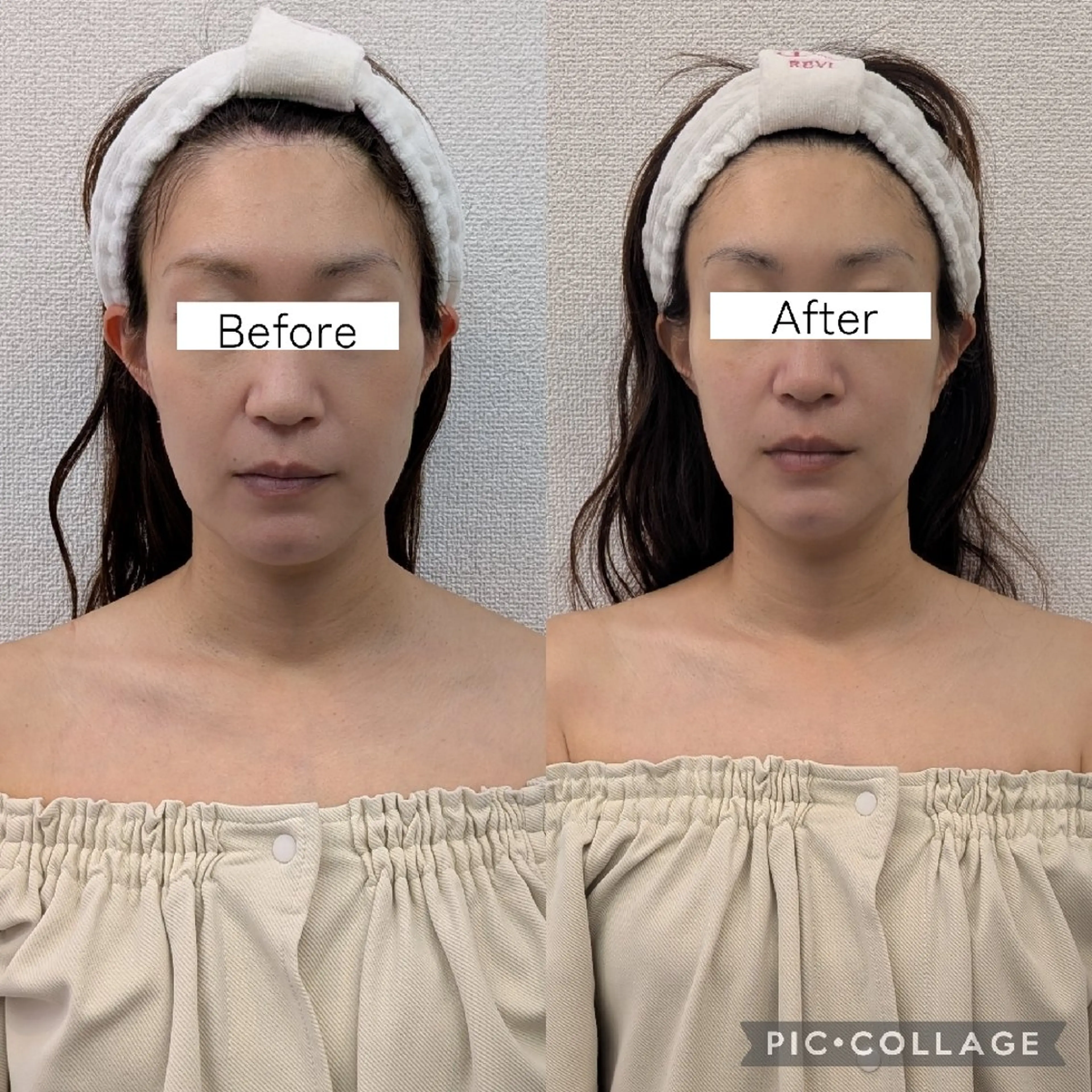 小顔フェイシャルケアの写真