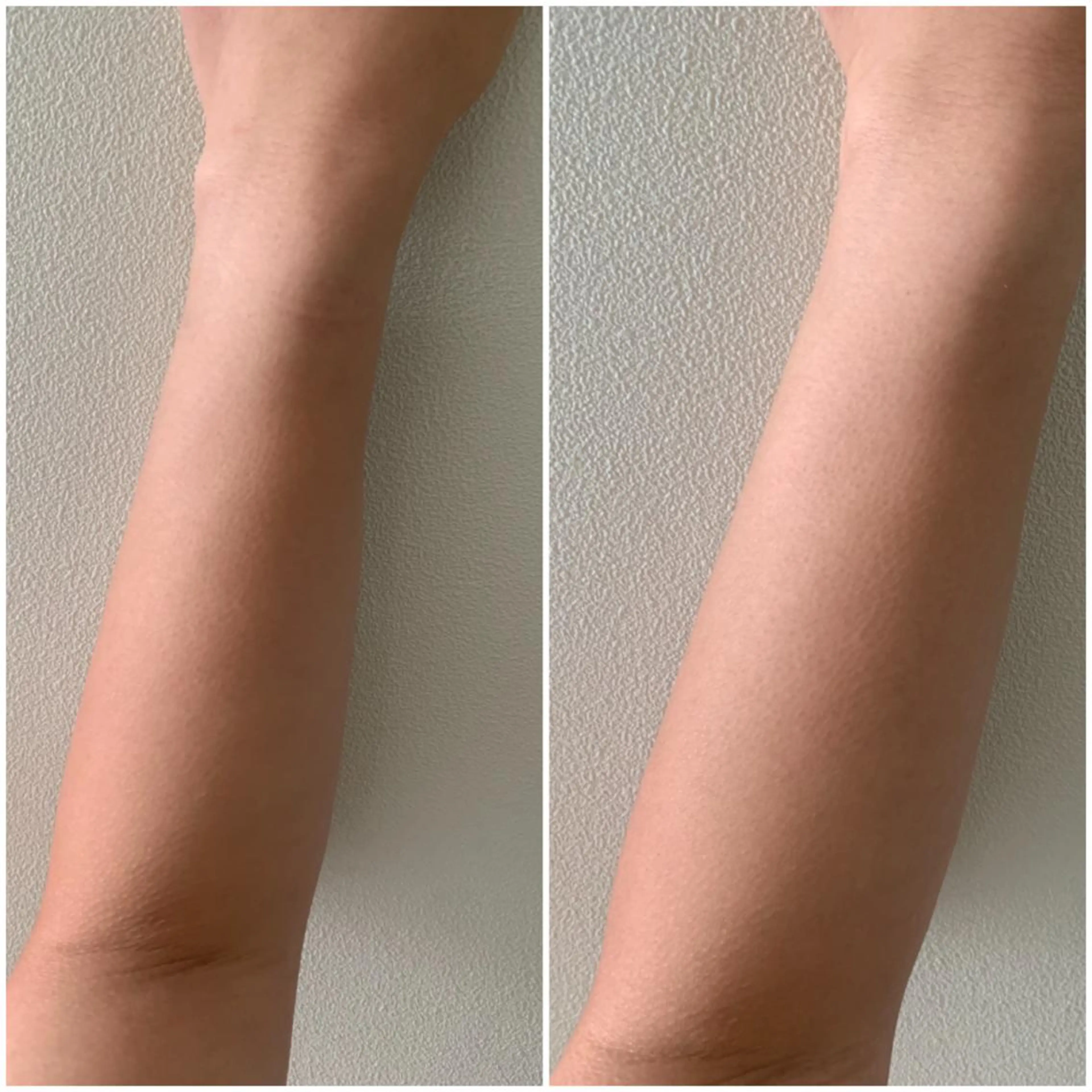 脱毛 aliaハイフ&水光ジェットサロン所属・aliaハーブ水光店 エステティシャン募集のエステ・リラクイメージ