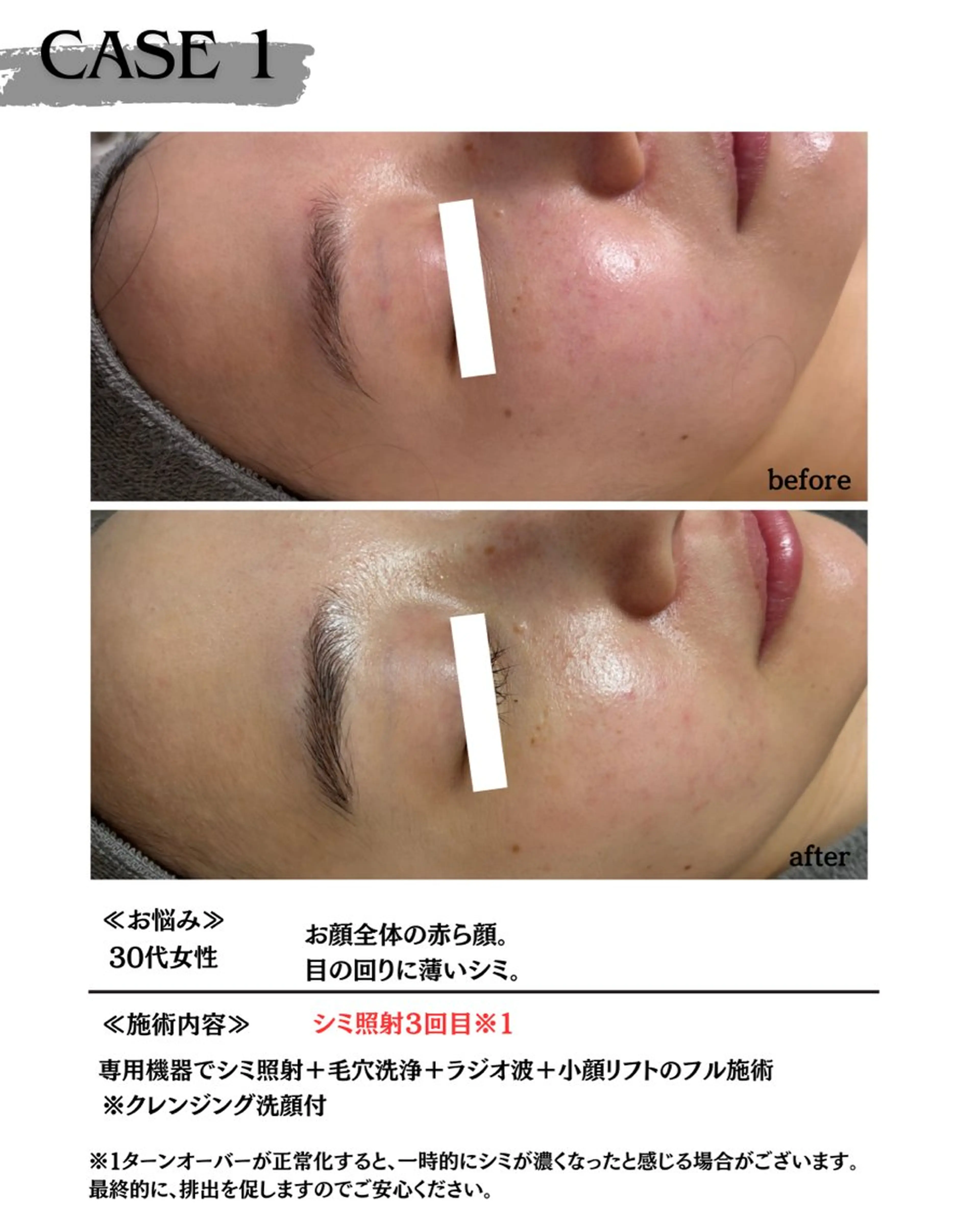 エステ 素肌育成・シミケア専門サロン美潤-miulu-所属・【医療提携サロン】 【シミケア専門】のエステ・リラクイメージ