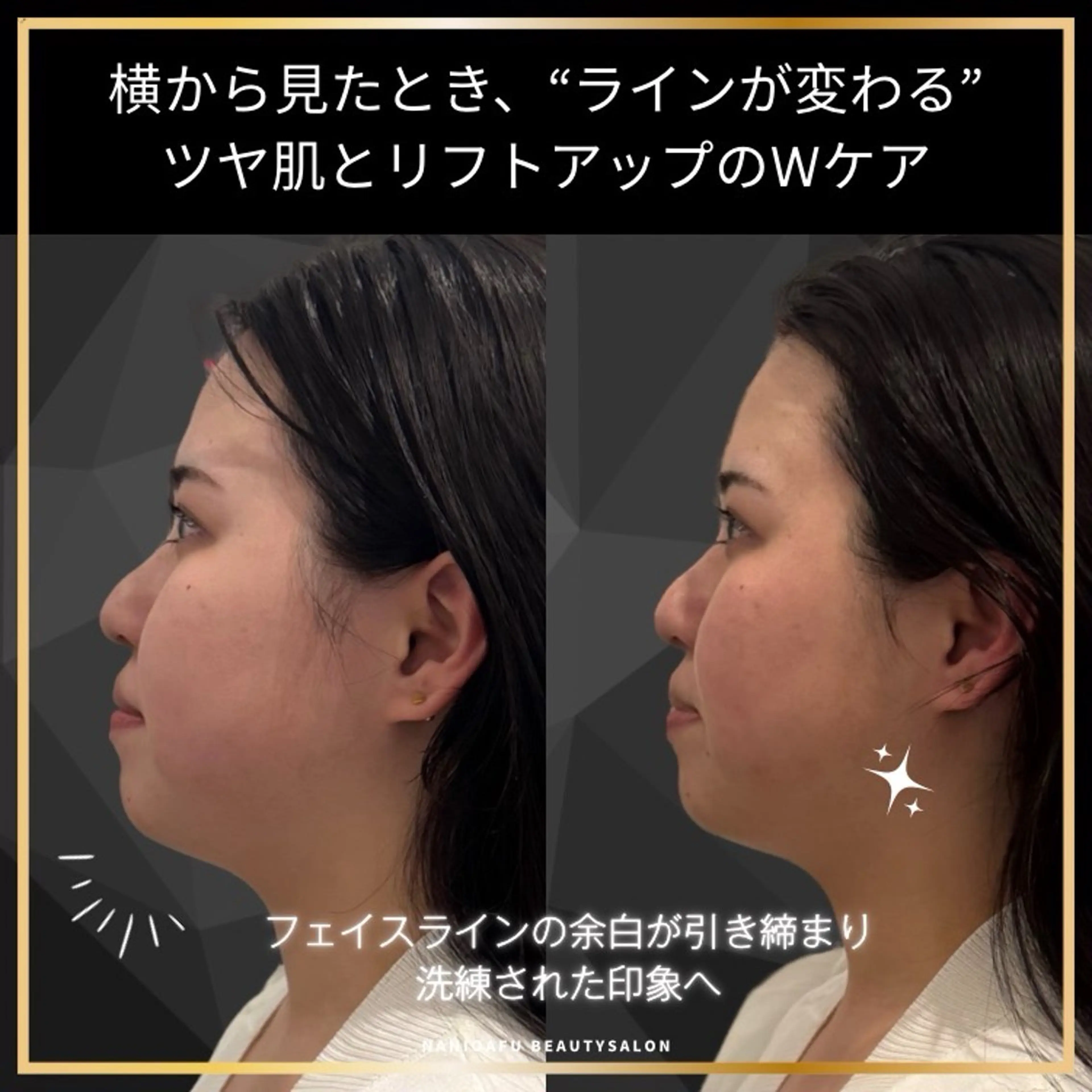その他 NANI OAFU所属・NANIOAFU [なんば店］のエステ・リラクイメージ